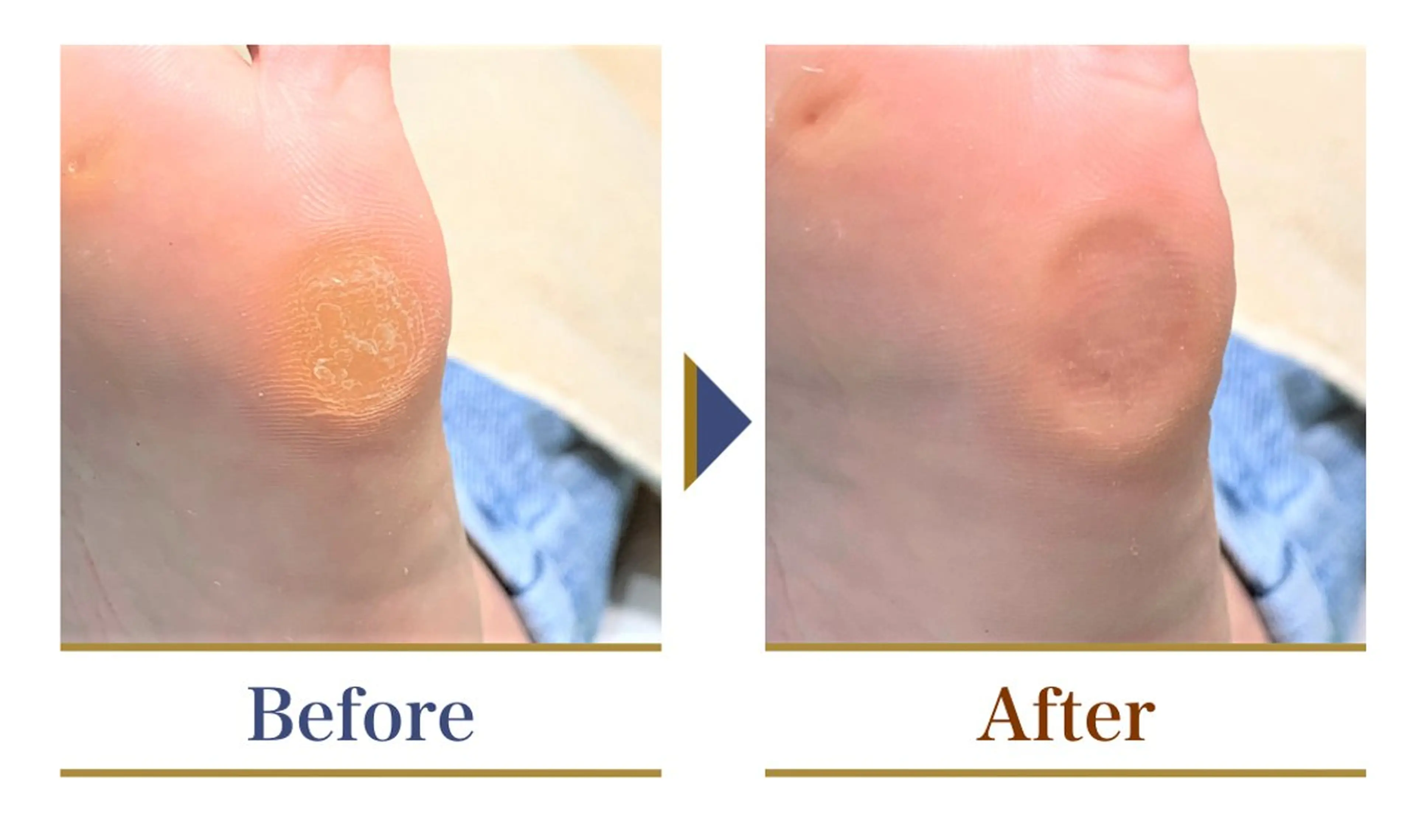 巻き爪補正店 横浜関内店のネイルデザイン