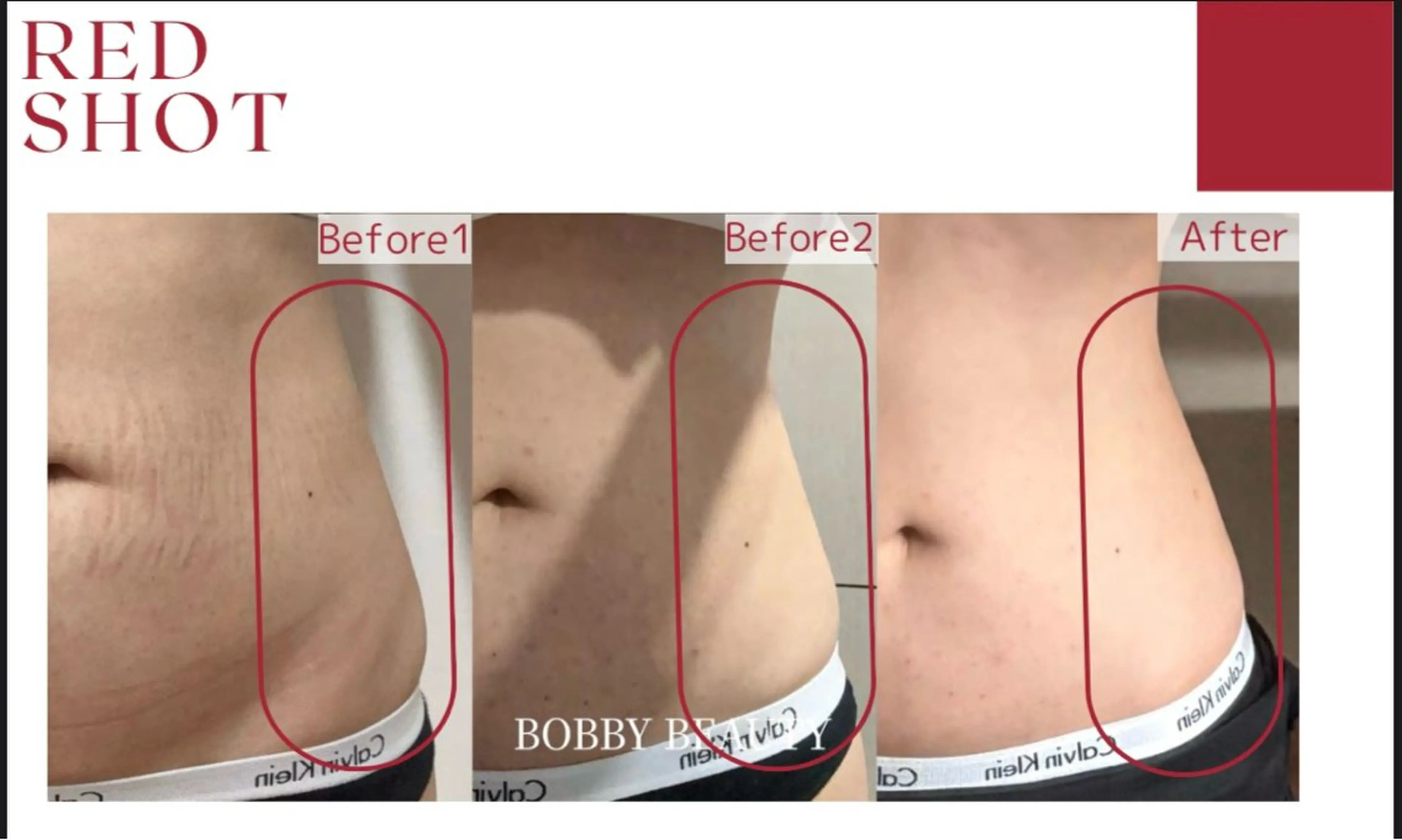 【REDSHOT】腰周り改善集中コースの写真