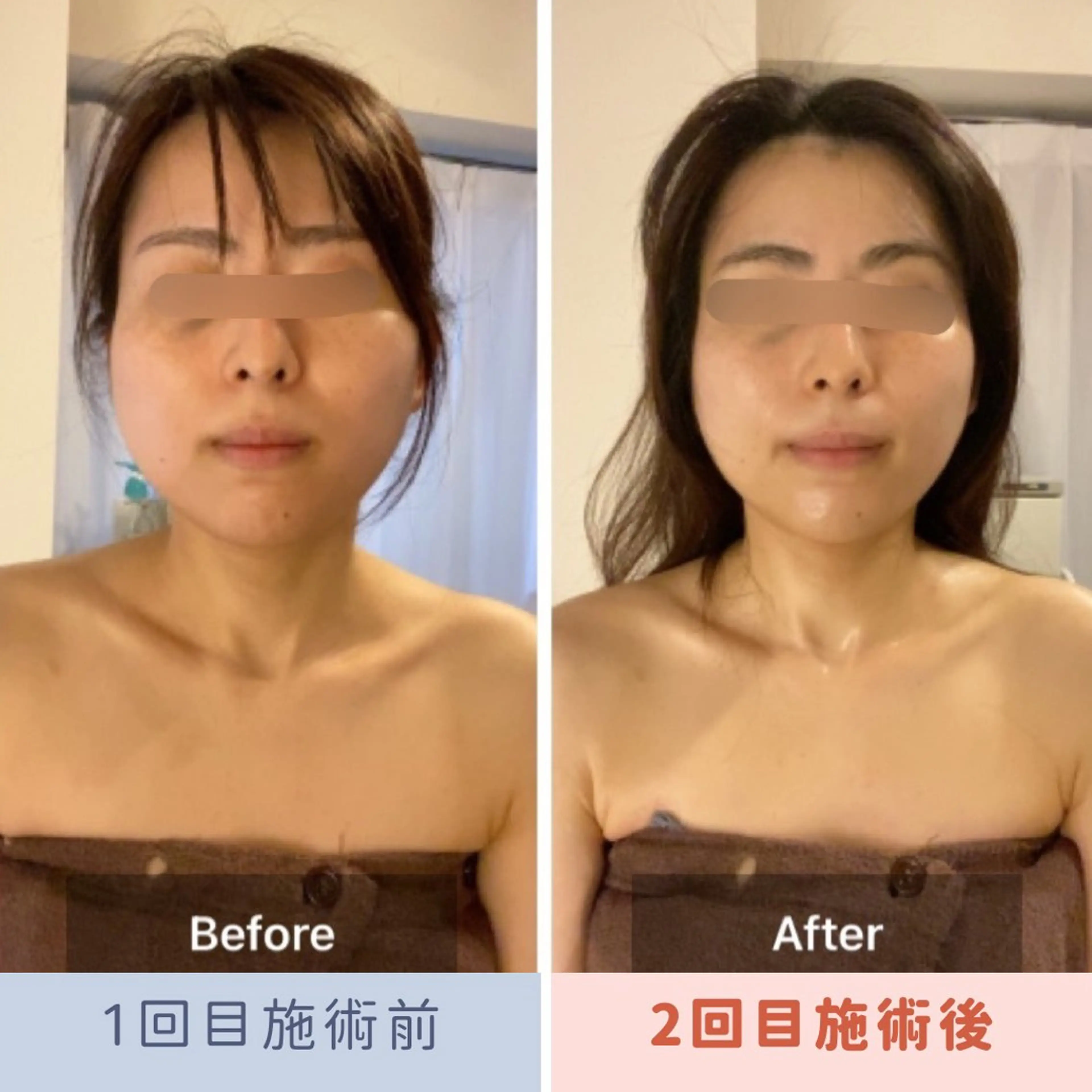 エステ 眉毛×小顔矯正サロン パピヨンsakiのエステ・リラクイメージ