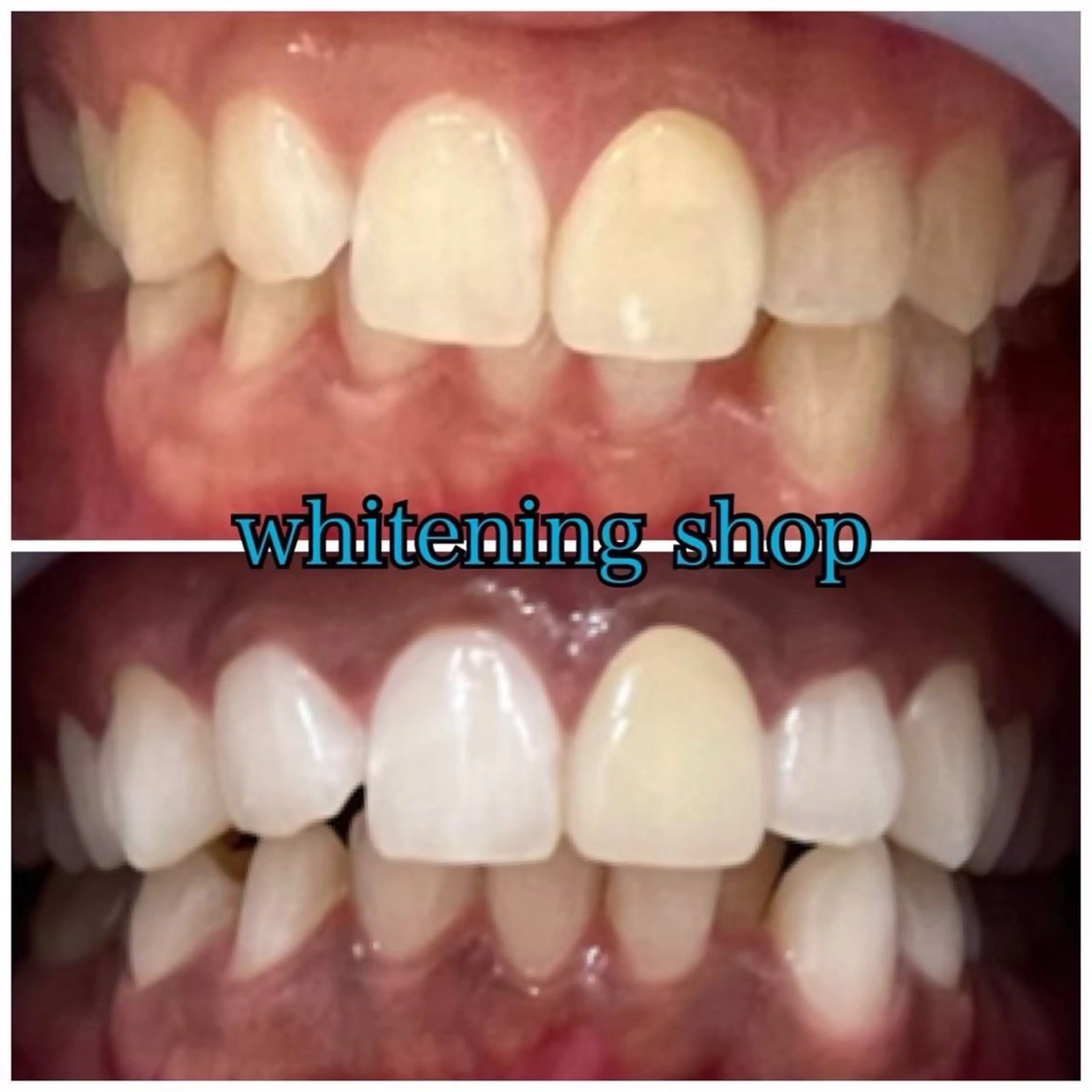 その他 ホワイトニングショップ静岡葵区店所属・ホワイトニング ショップ葵区静岡駅店のその他イメージ