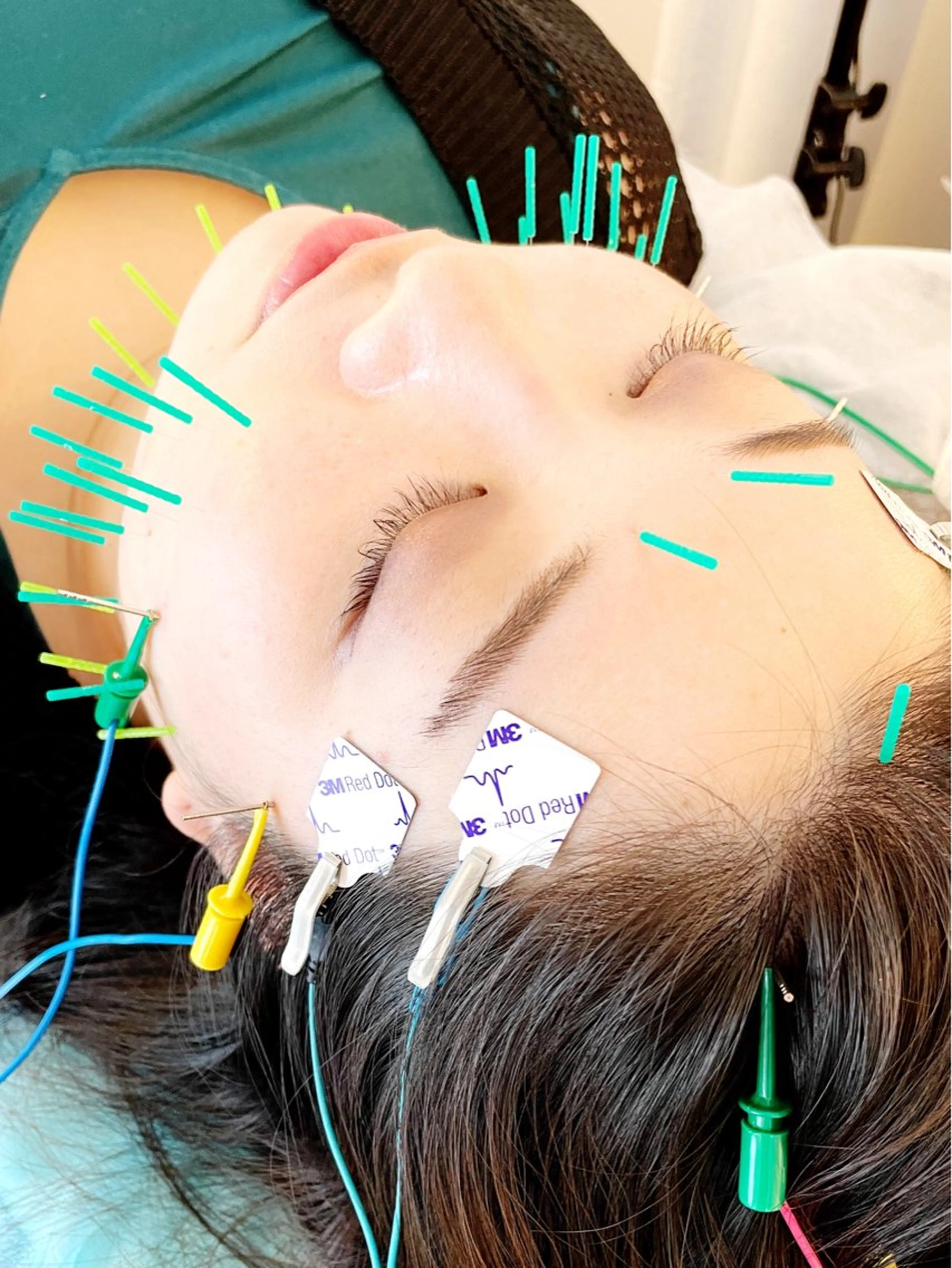 エステ リラク 小顔美容鍼専門サロン 渋谷YZのエステ・リラクイメージ