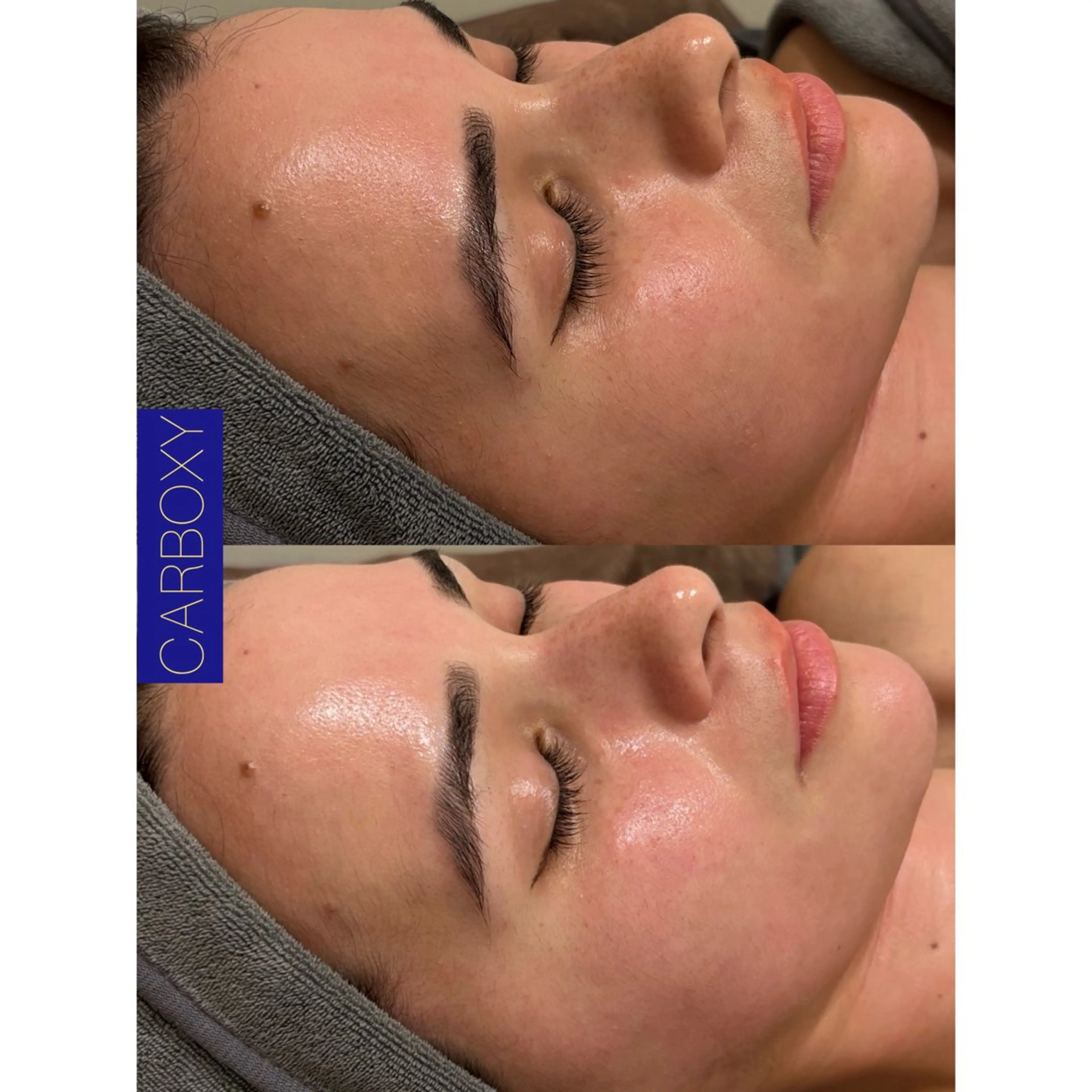 その他 ☆痩身/小顔☆ コルギのエステ・リラクイメージ