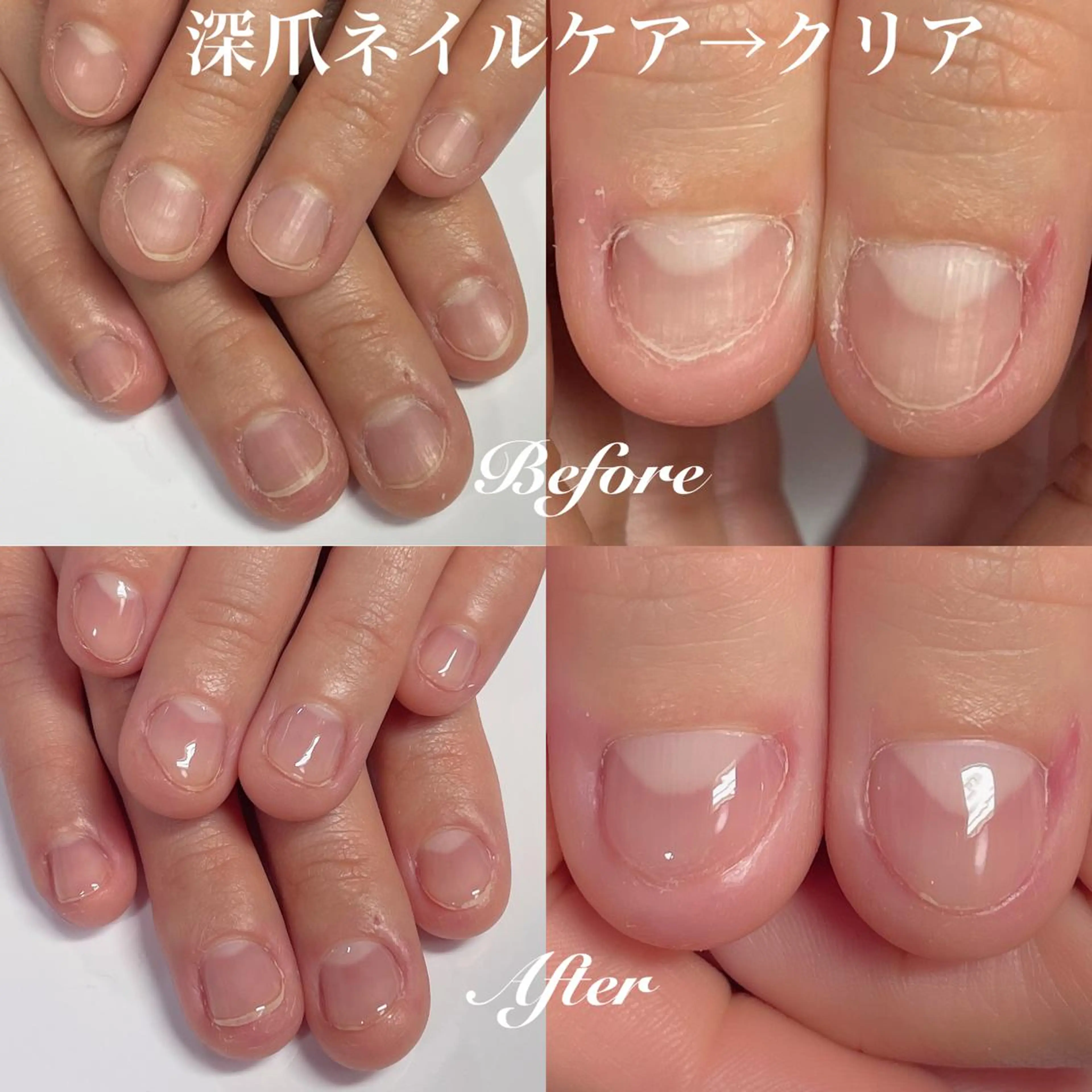 ネイル クリアネイル ジェルネイル .Nails Mio 赤羽西ネイルサロンのネイルデザイン