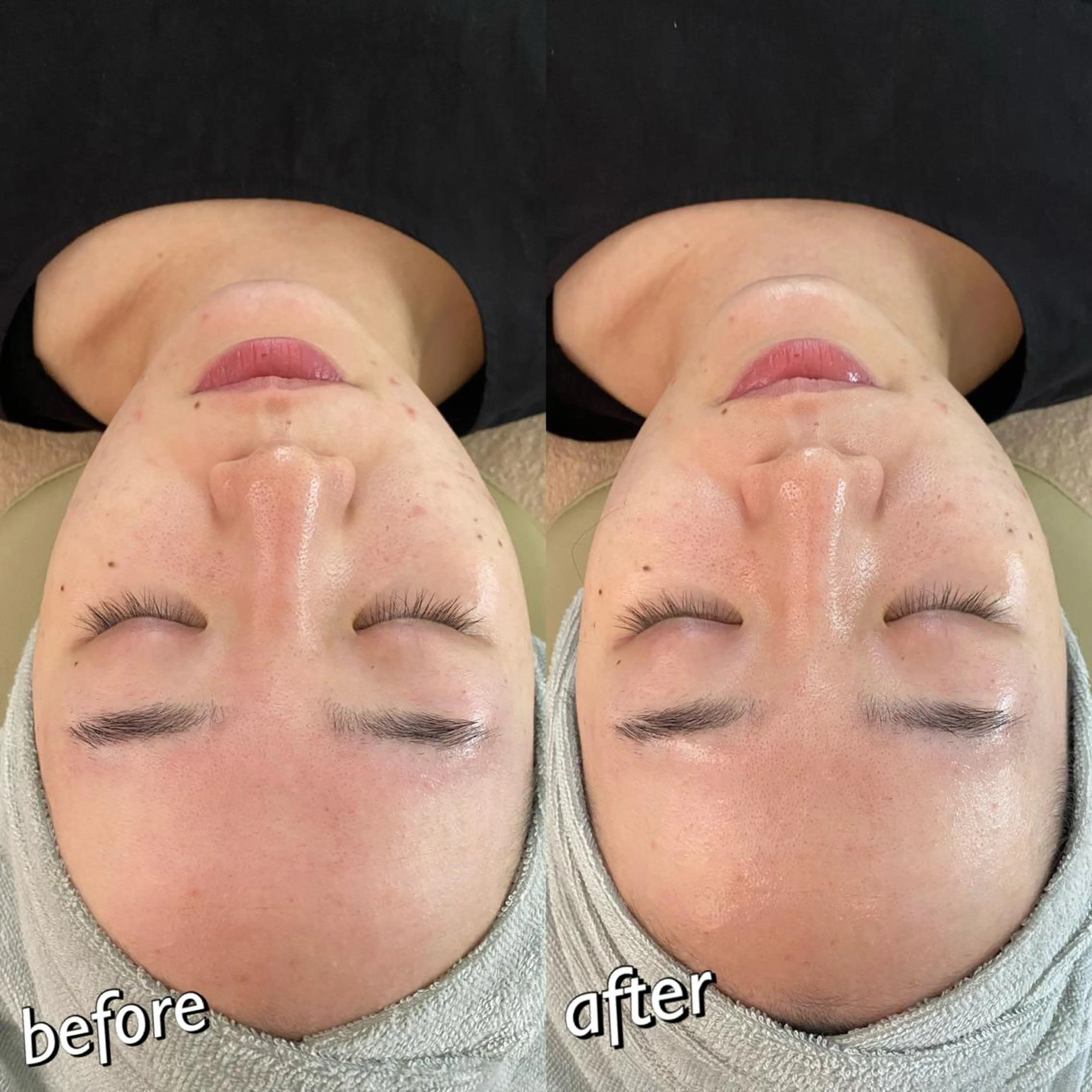 うなじ脱毛/美肌脱毛 LABELのエステ・リラクイメージ