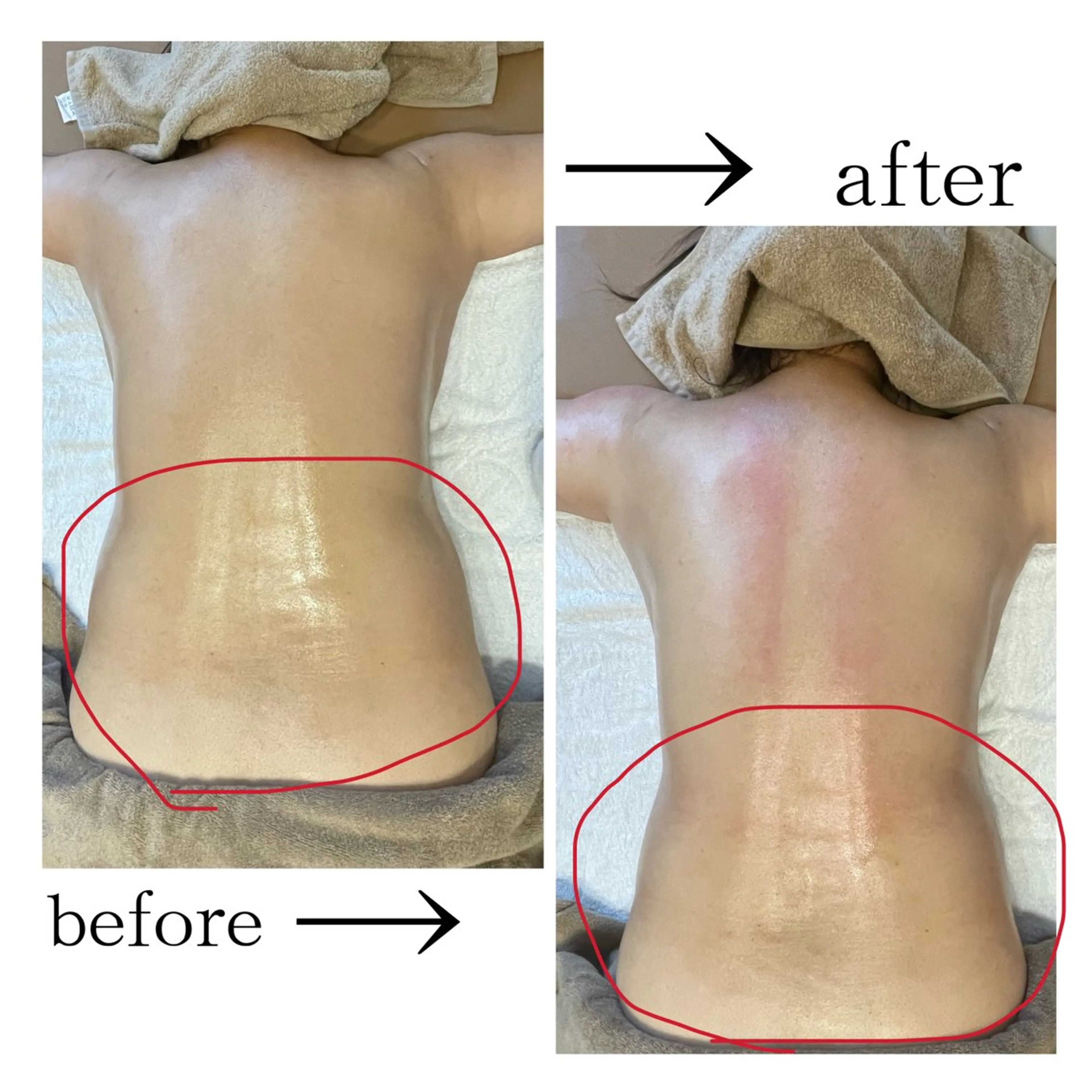 LILY REBBONのエステ・リラクイメージ