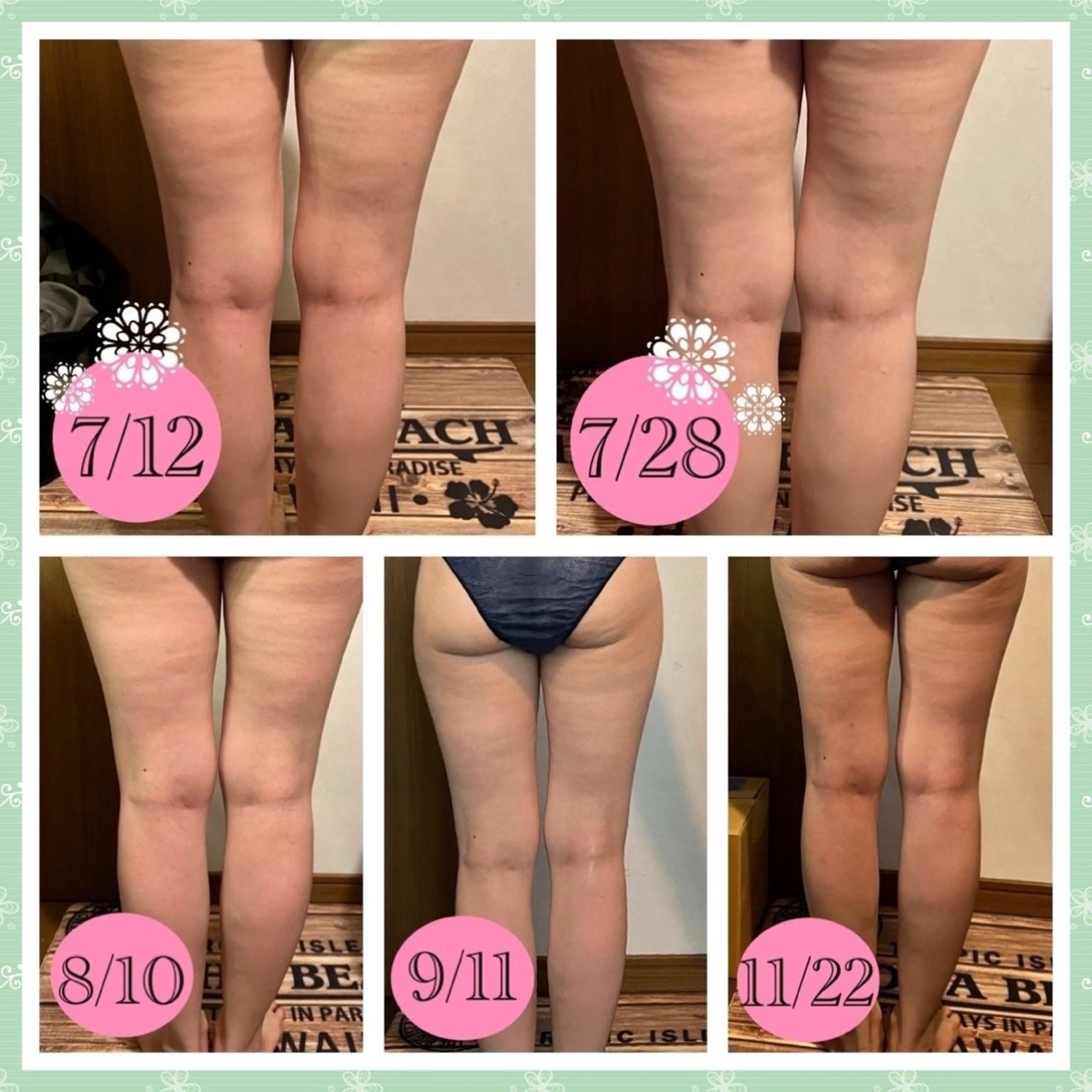 痩身エステ　下半身コース　期間限定プライスの写真