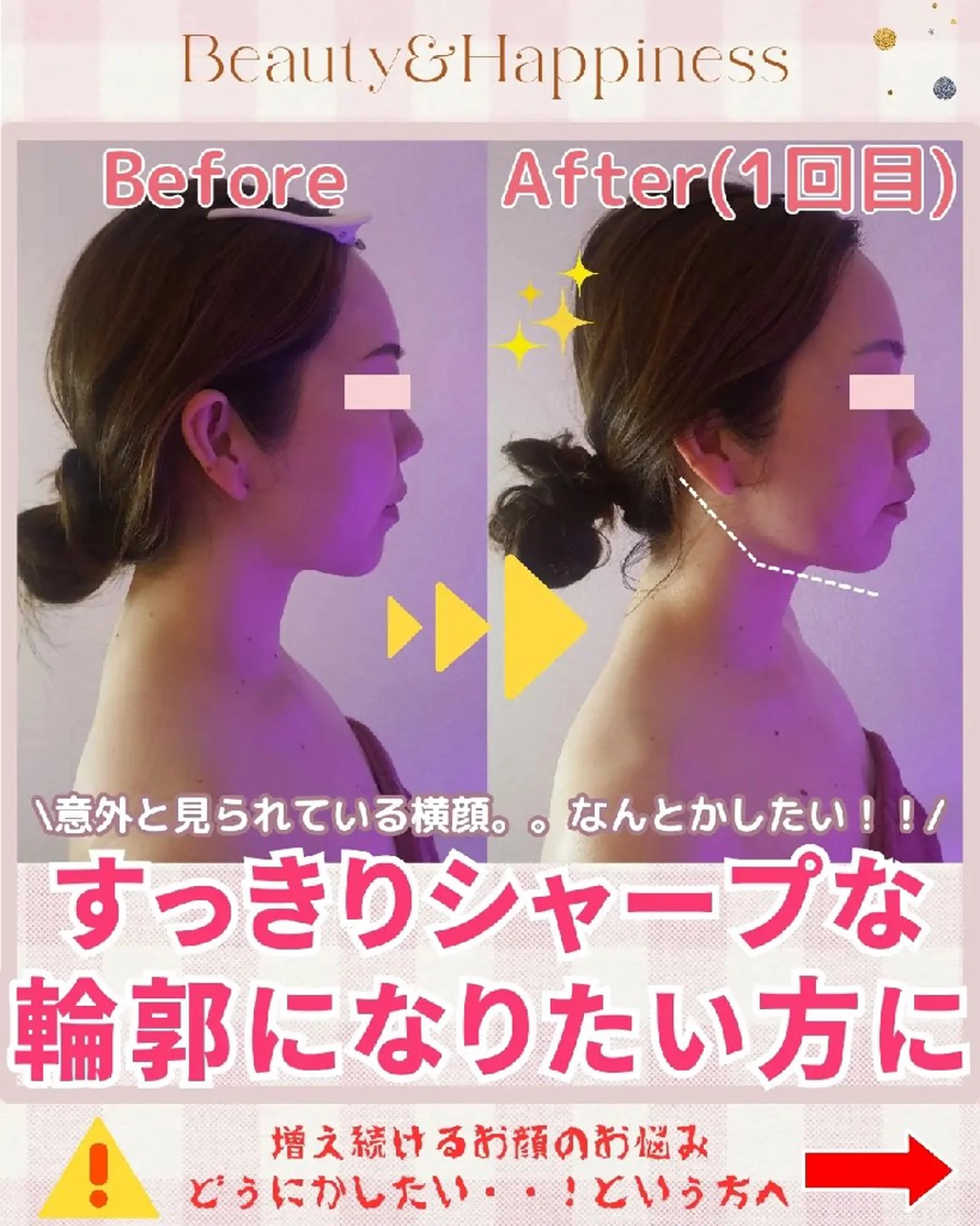 痩身ハーブピーリング 筋膜リリース☆B&Hのエステ・リラクイメージ