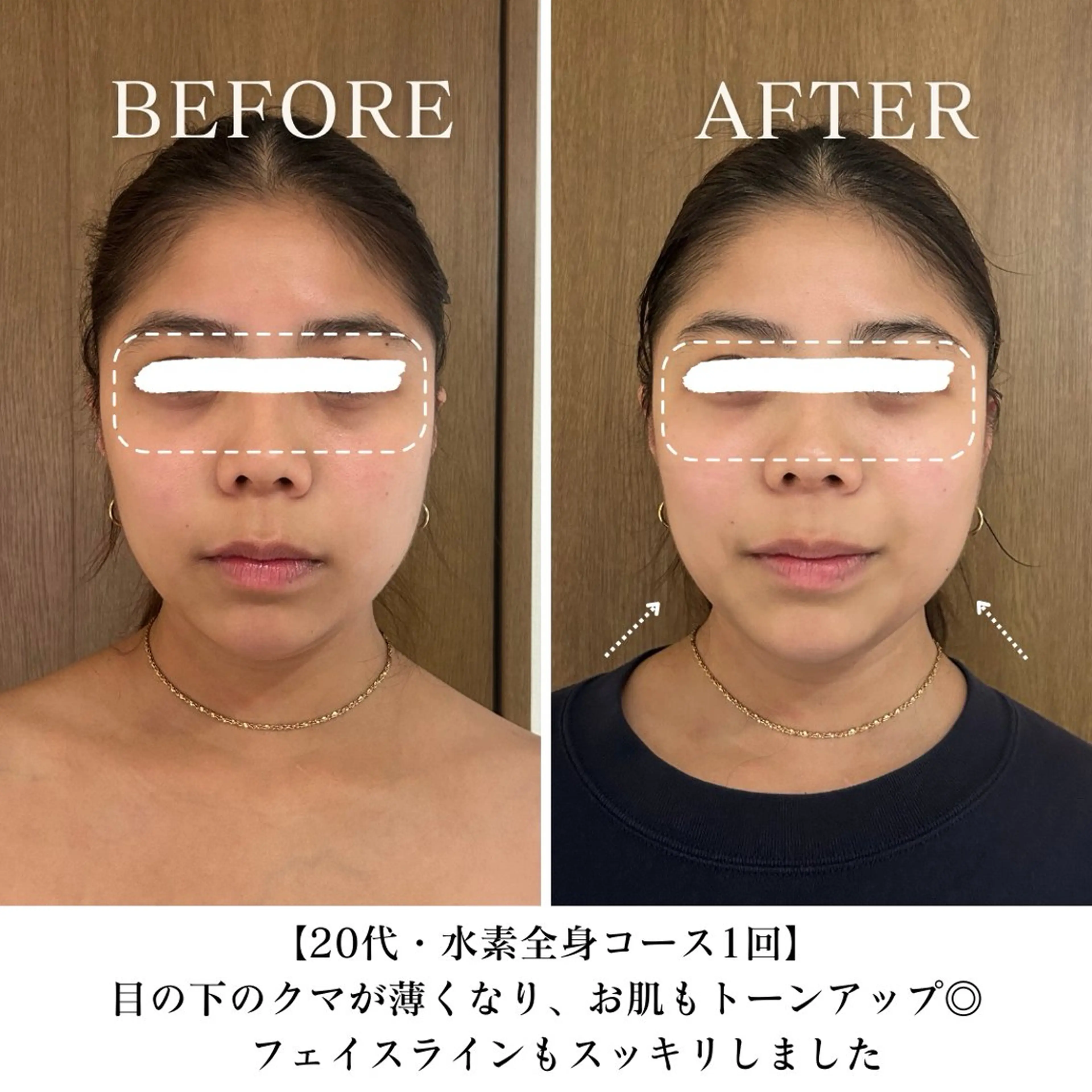 エステ リラク 【目黒】本格痩身✴︎ 最新型よもぎ蒸しのエステ・リラクイメージ