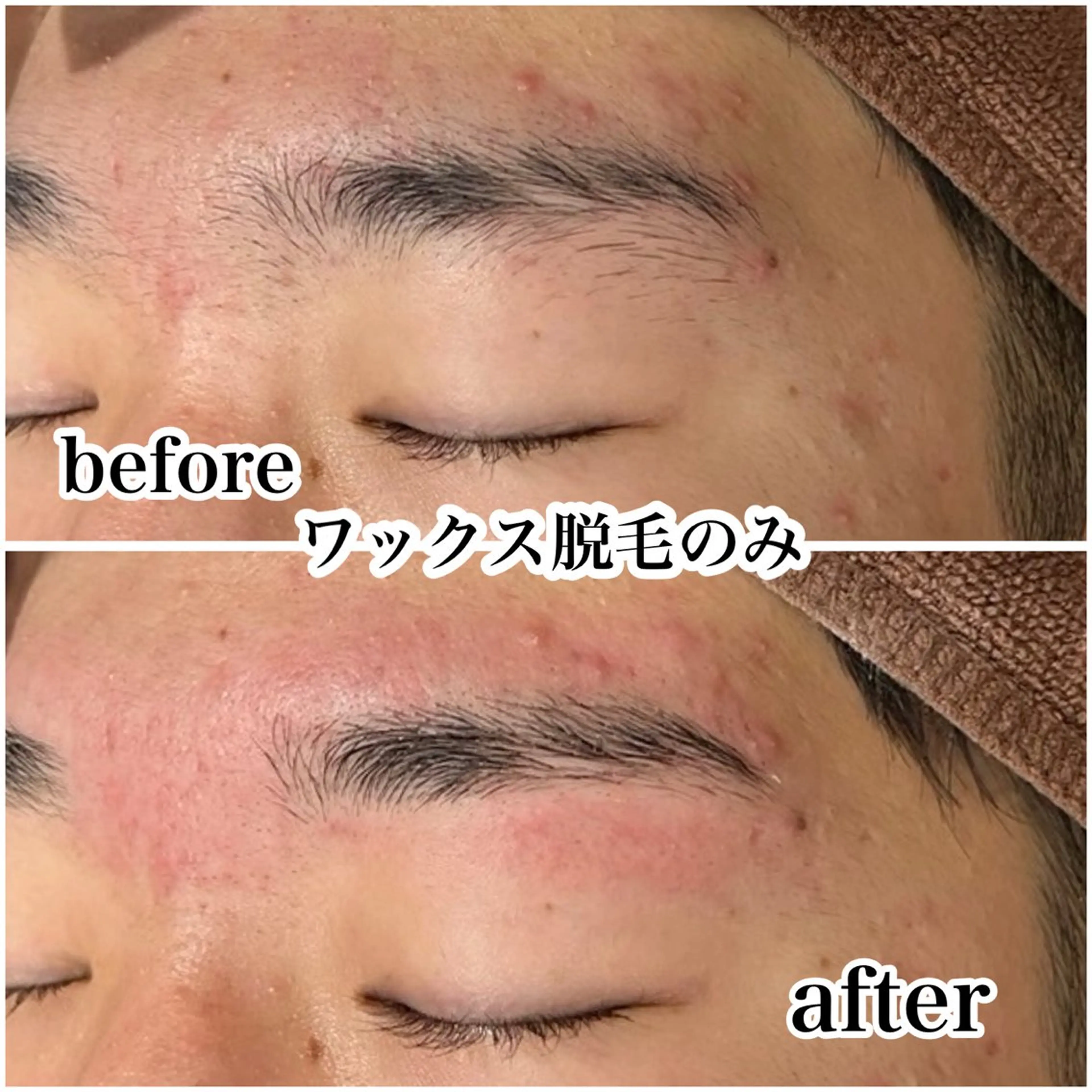 メンズ アイブロウ ワックス脱毛 その他(アイブロウ) メンズ脱毛&メンズ眉毛サロン  kyle.横浜所属・メンズ眉/HBL/ sakiの眉毛・アイブロウイメージ