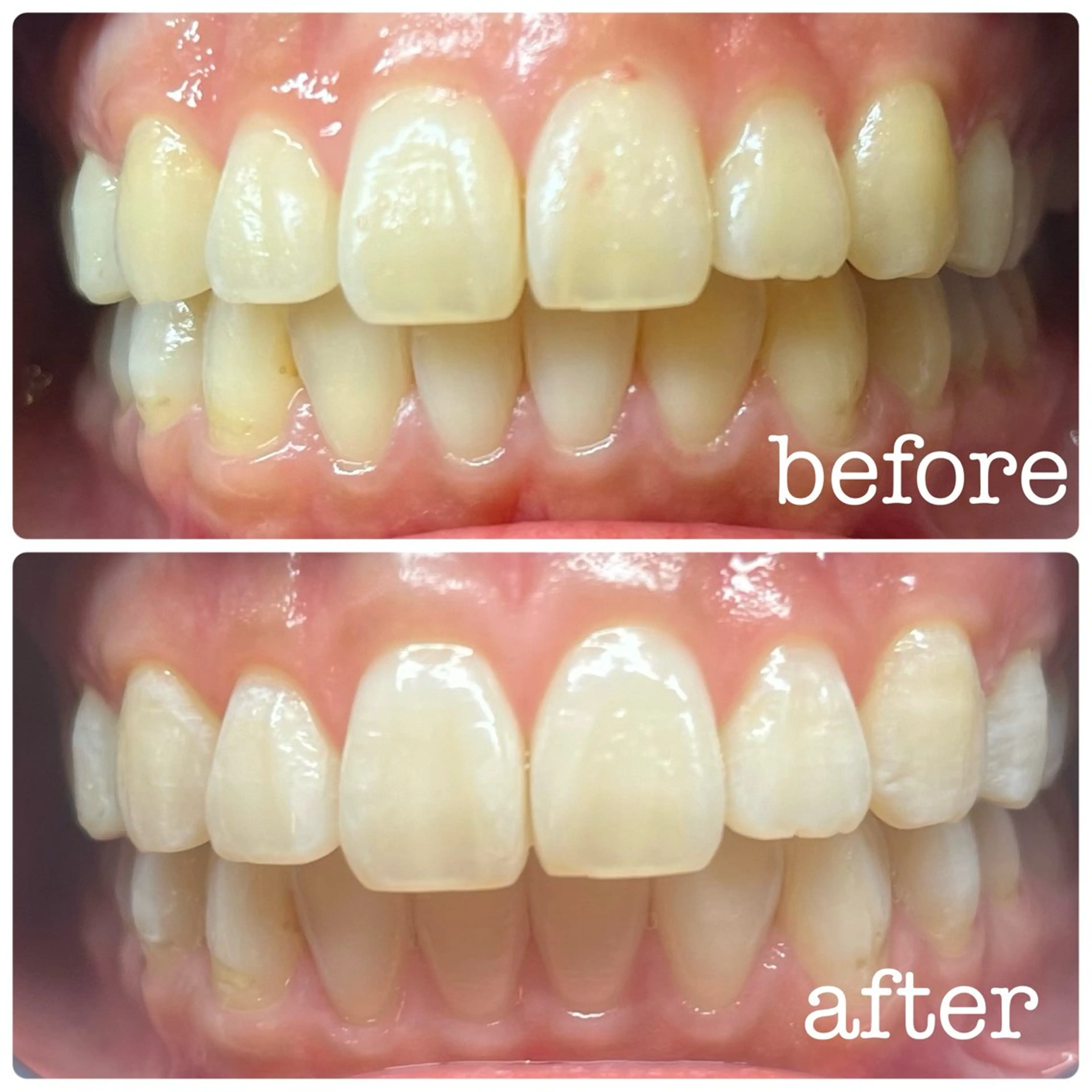 DH. MISATOの眉毛・アイブロウイメージ