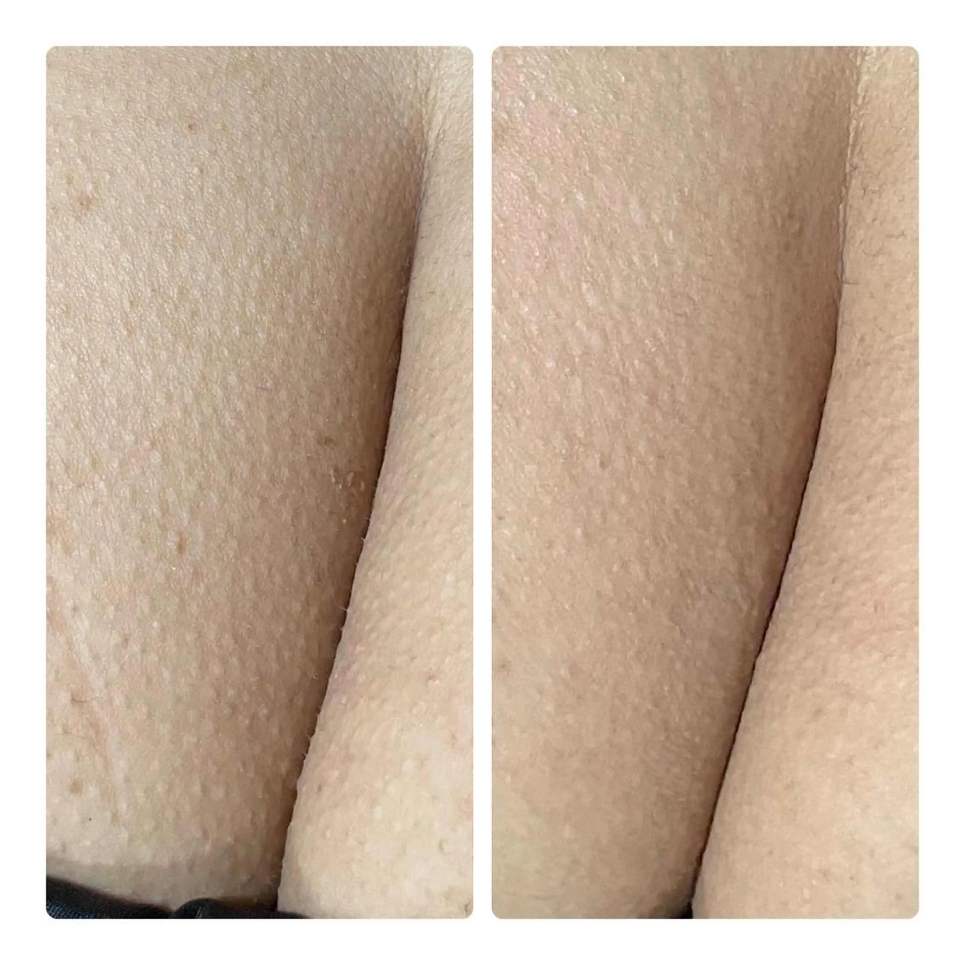 エステ リラク 【足圧】鬼👹リンパ 身体整うサロンのエステ・リラクイメージ