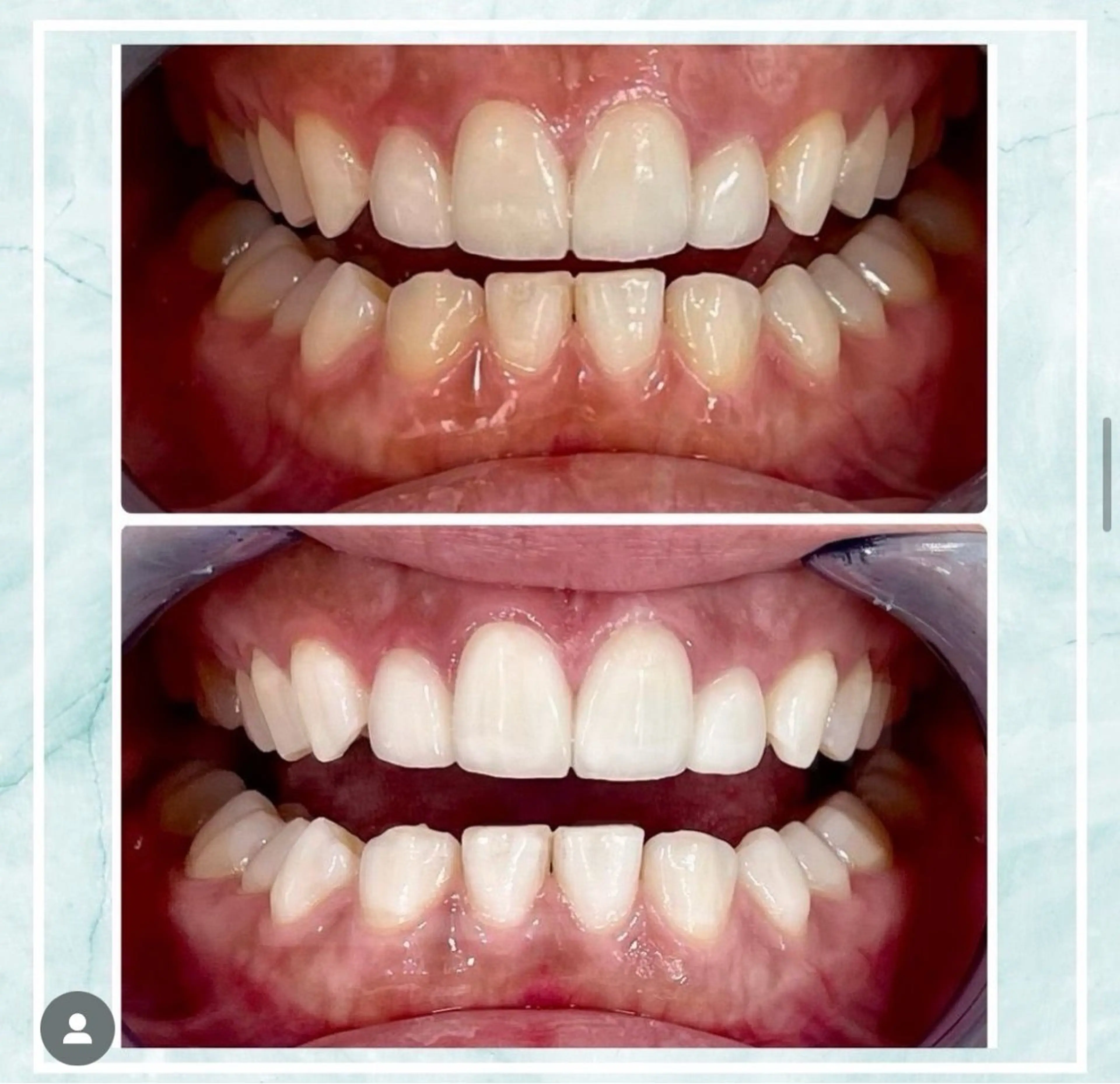 ホワイトニング ビューティ名古屋栄のその他イメージ