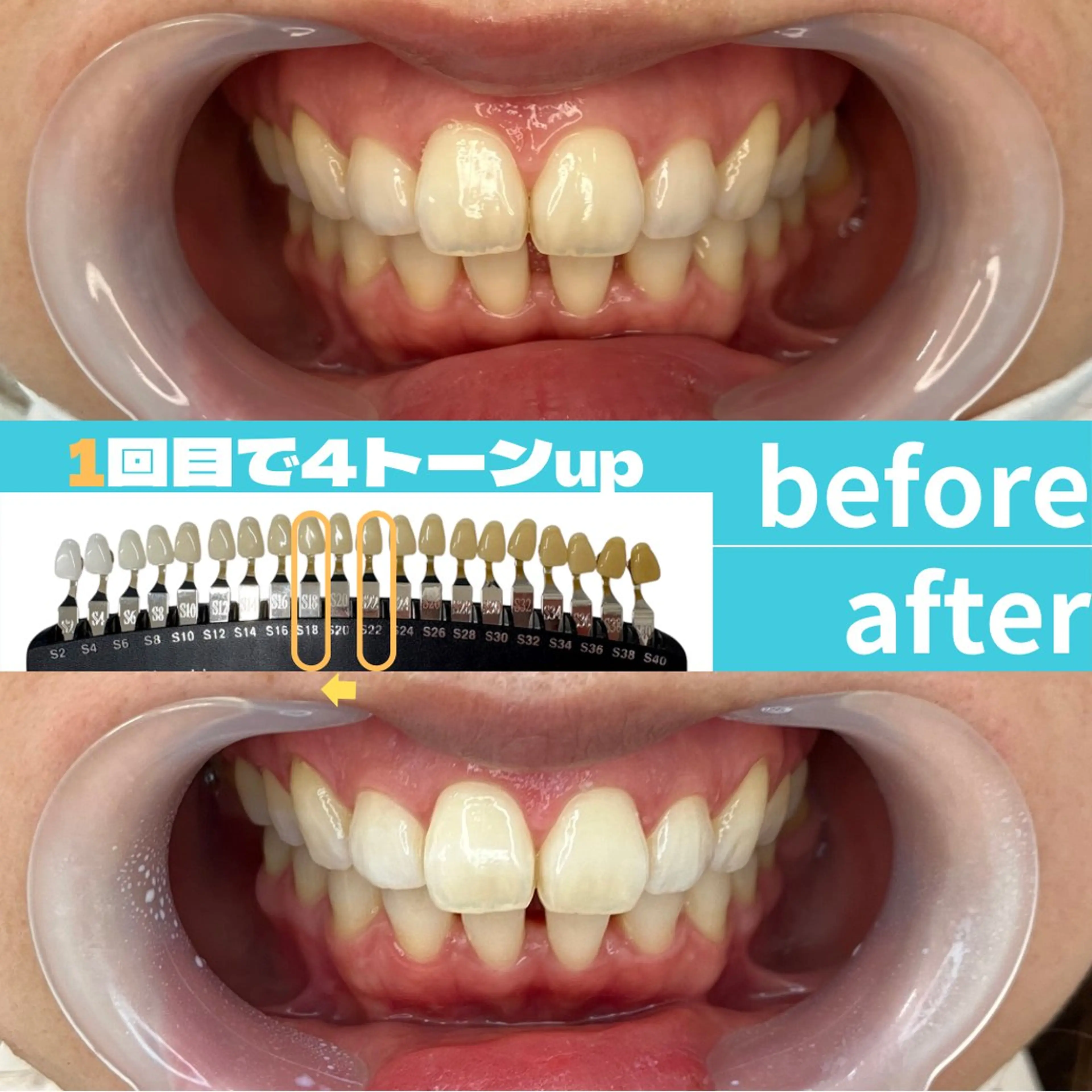 エステ s rikoのエステ・リラクイメージ