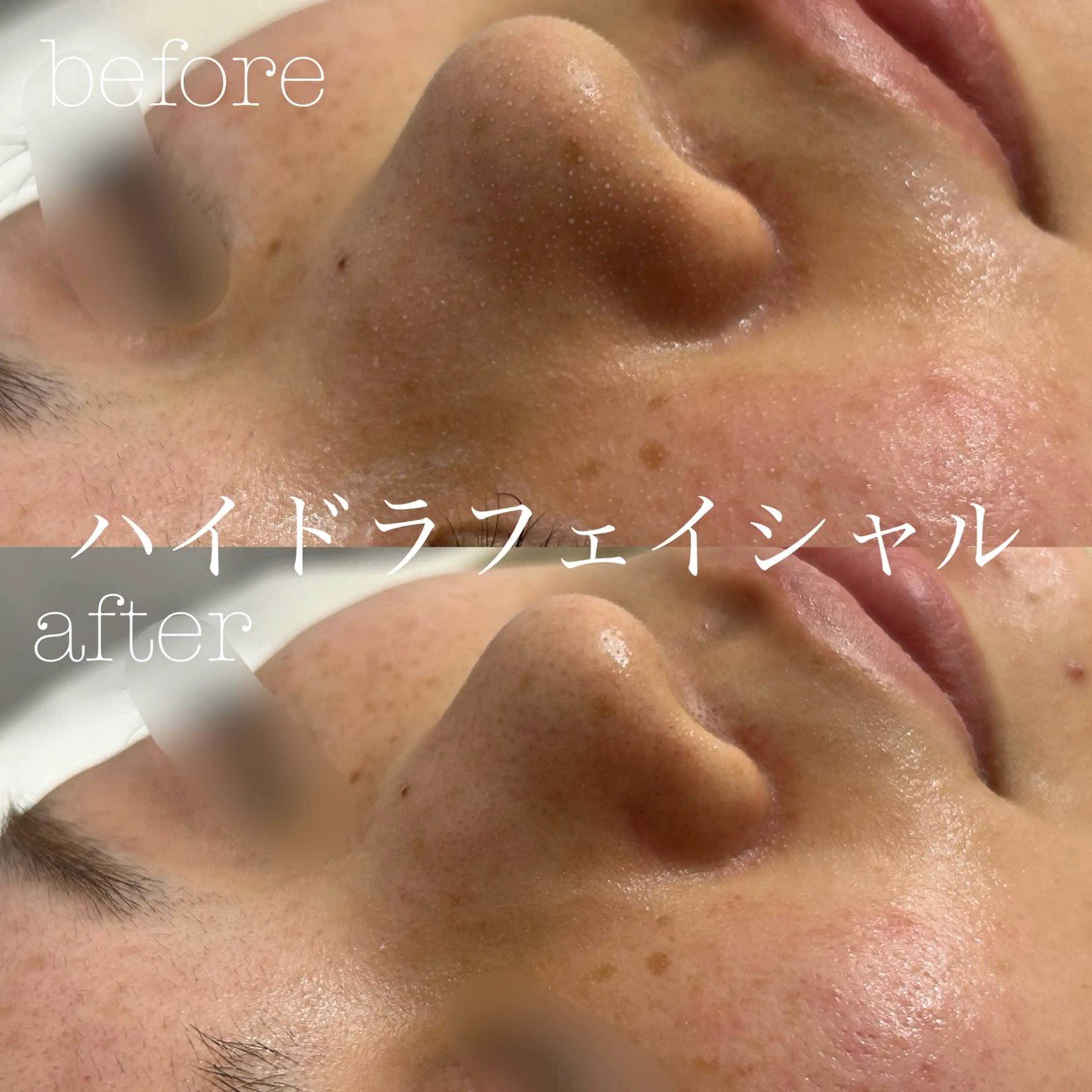 エステ フェイシャルサロン CHIARA 荒田のエステ・リラクイメージ