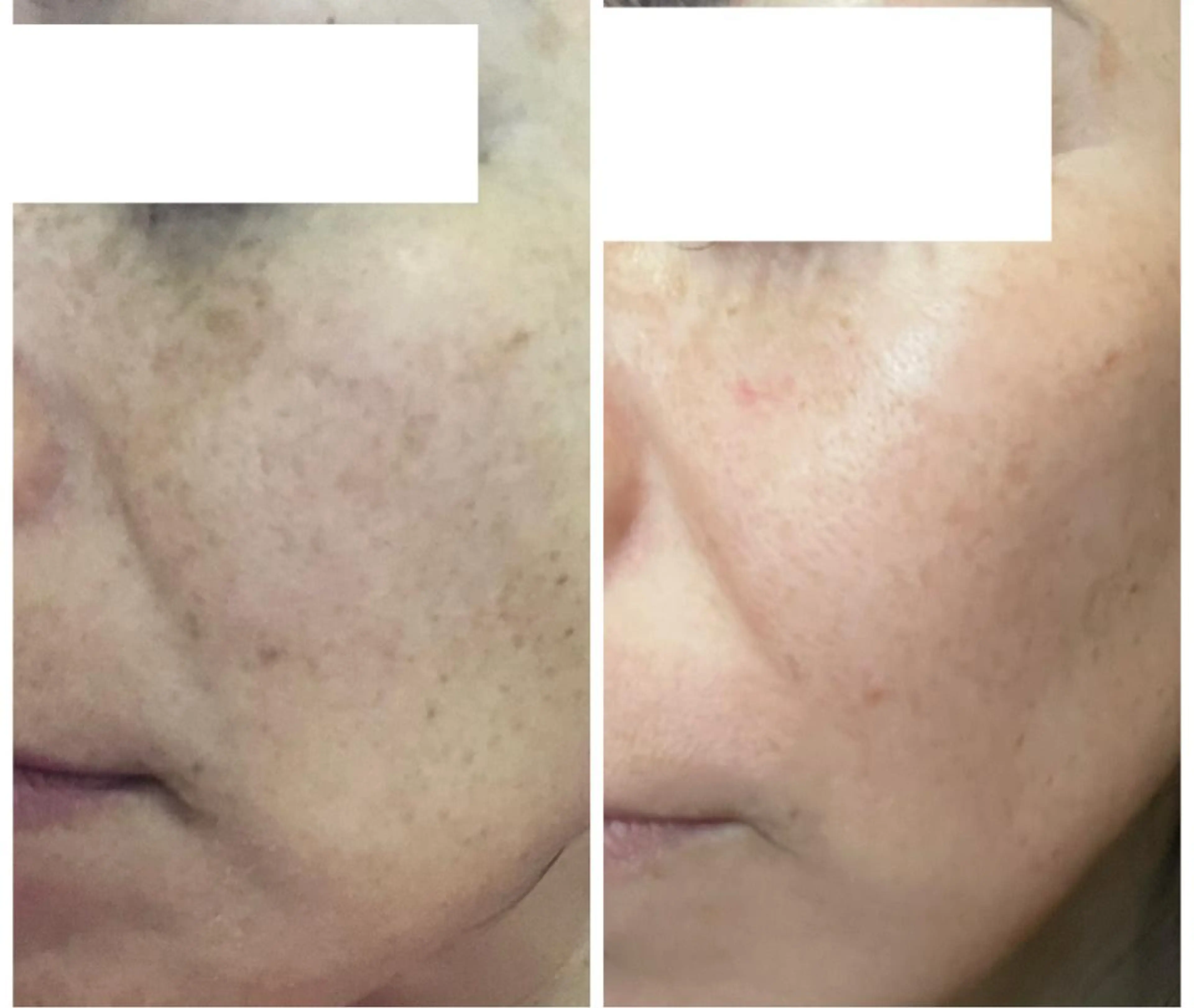 private salon  Dea_maris シュガーリング＆パーソナルボディケア所属・シミ改善・韓国肌管理 ボディメイク痩身のその他イメージ