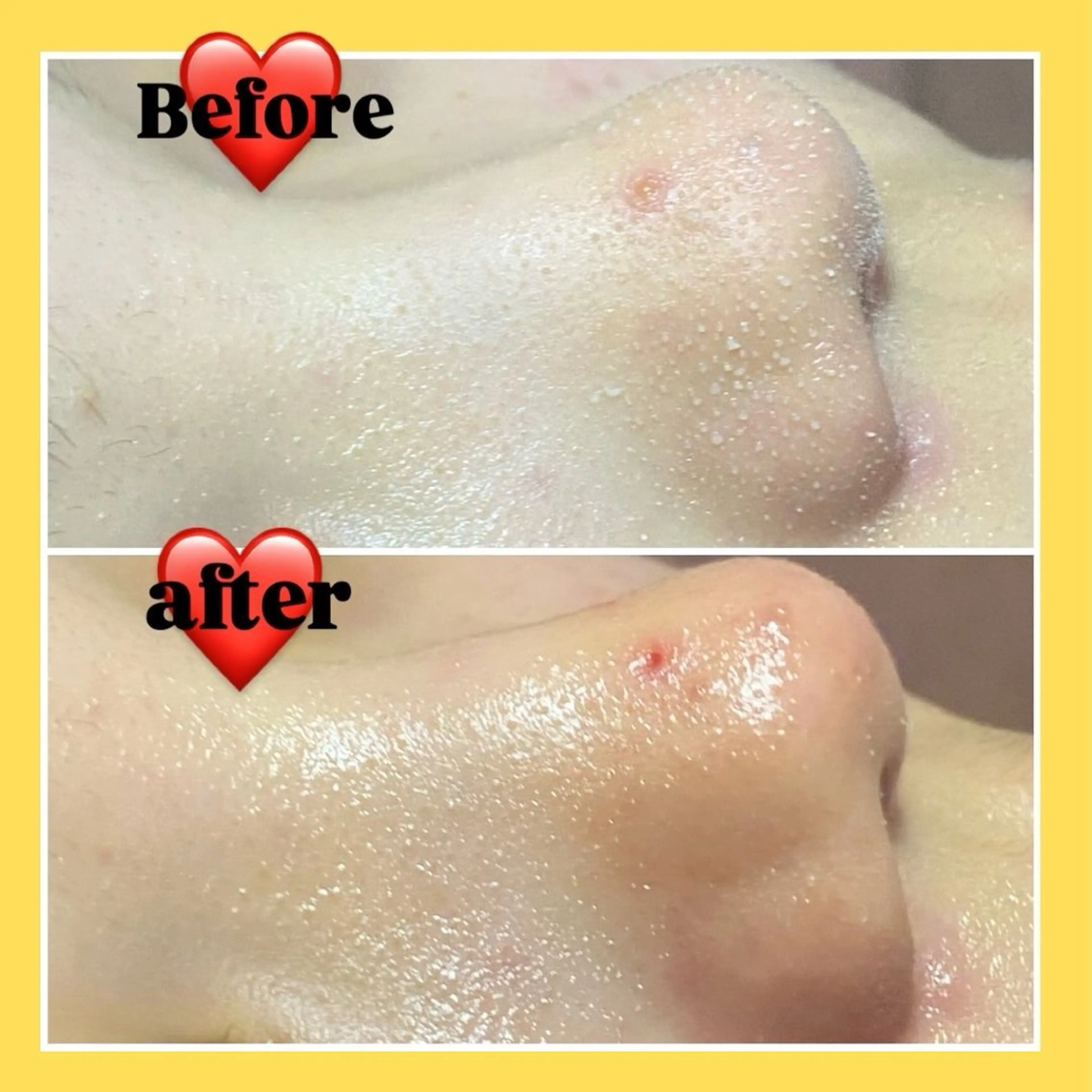 毛穴フェイシャル エステ専門店BBのエステ・リラクイメージ