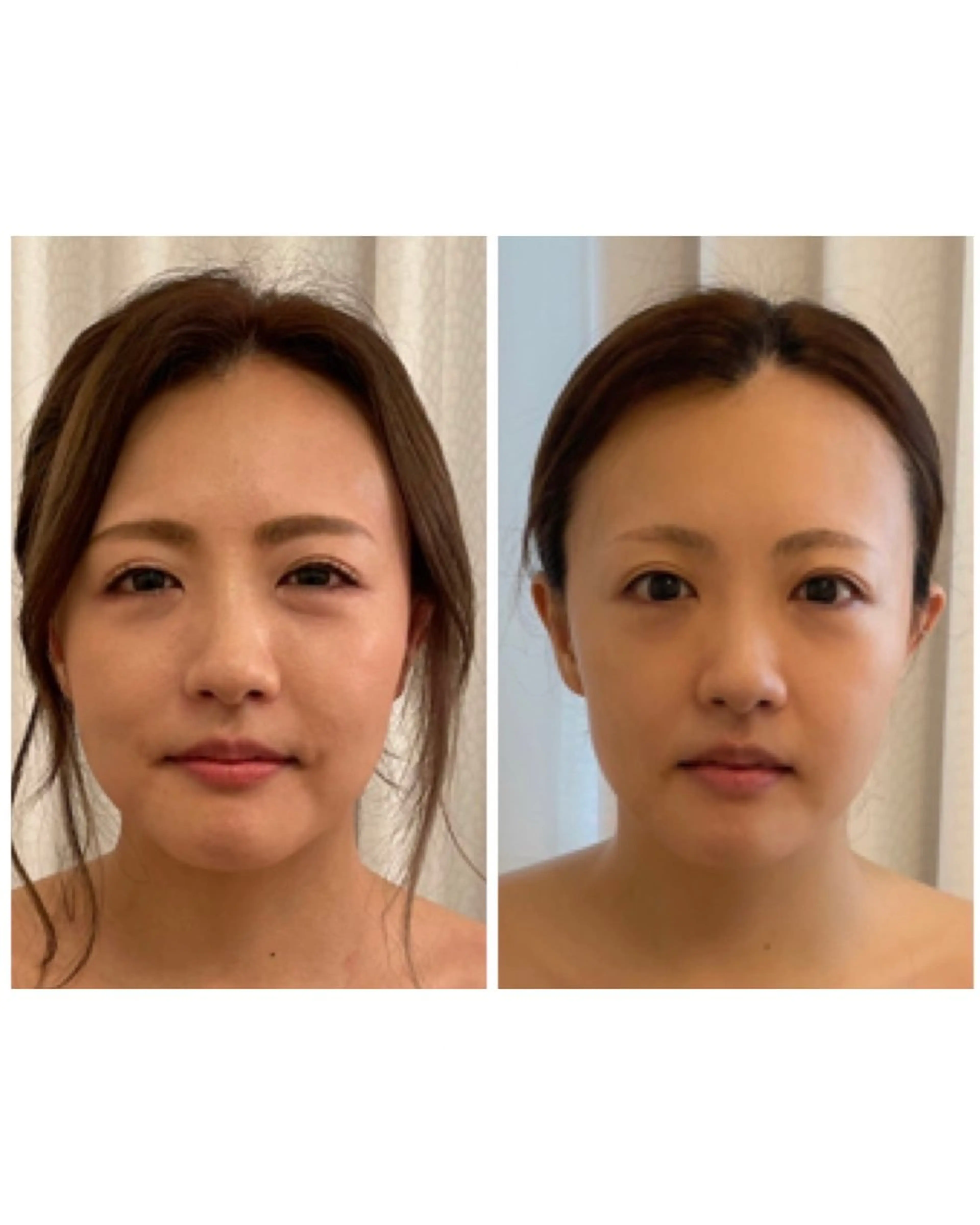 エステ リラク 小顔コルギ＆オイル アンドエスのエステ・リラクイメージ