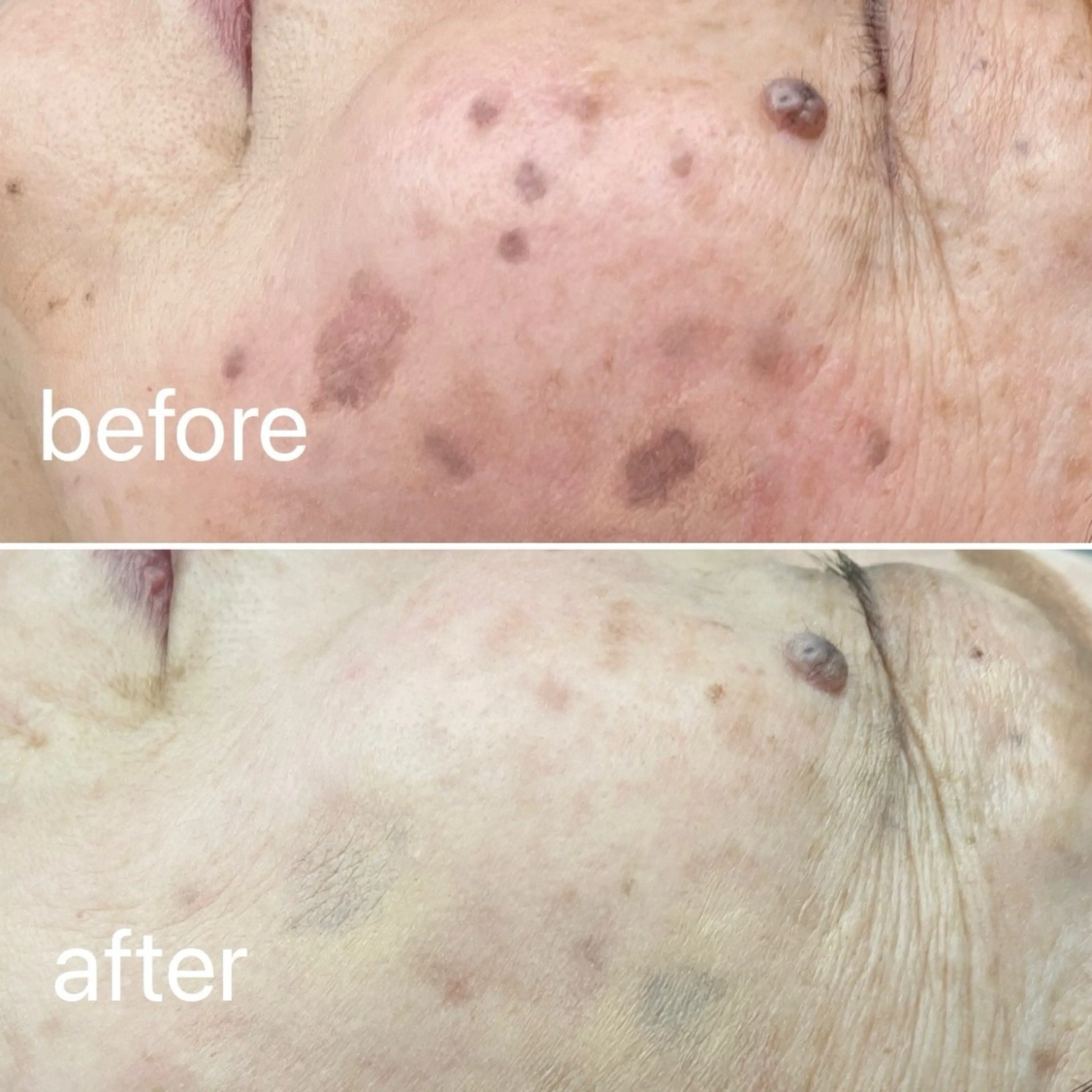 痛くないシミ取り 【荻窪】石橋のヘアスタイル