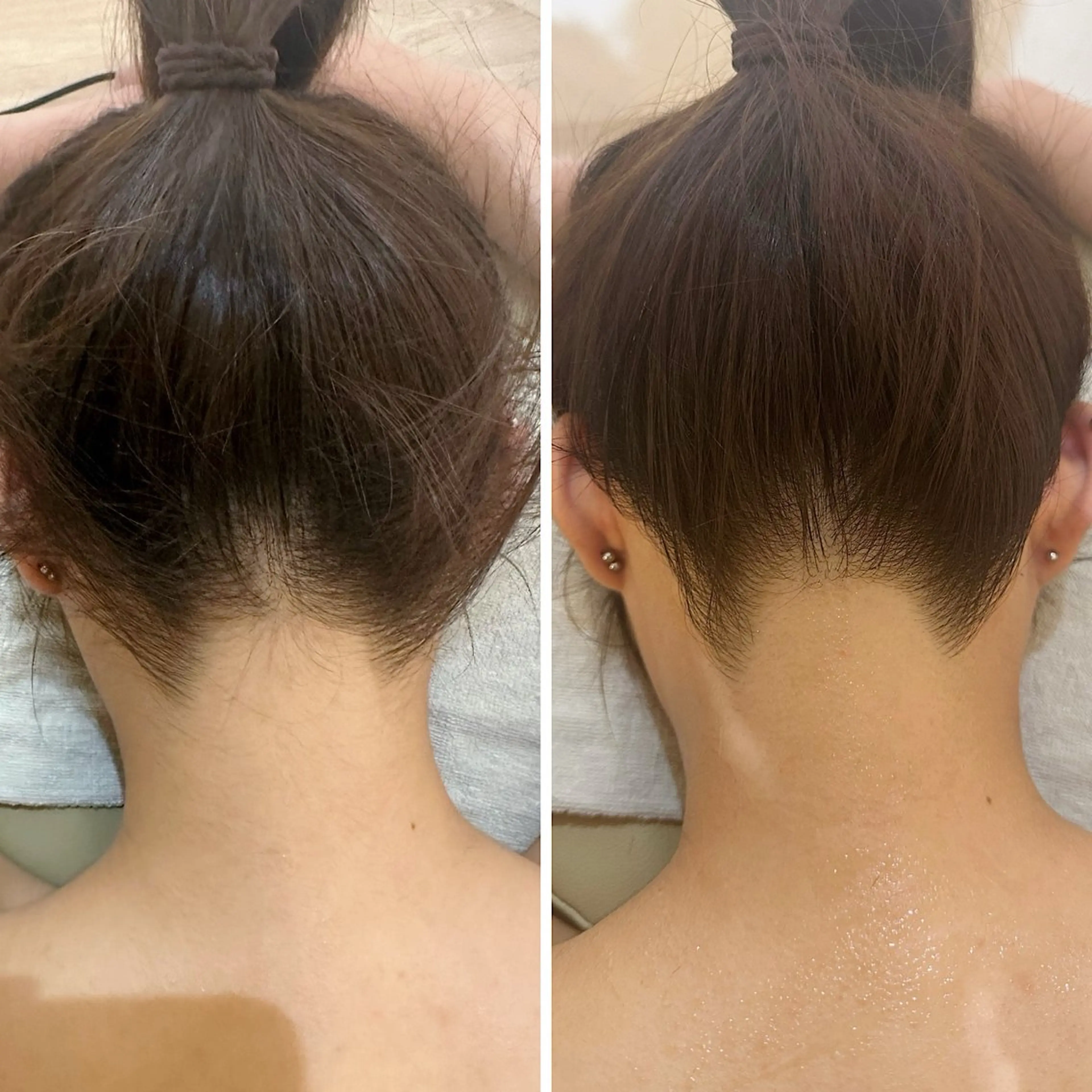 脱毛 うなじ脱毛/美肌脱毛 LABELのエステ・リラクイメージ