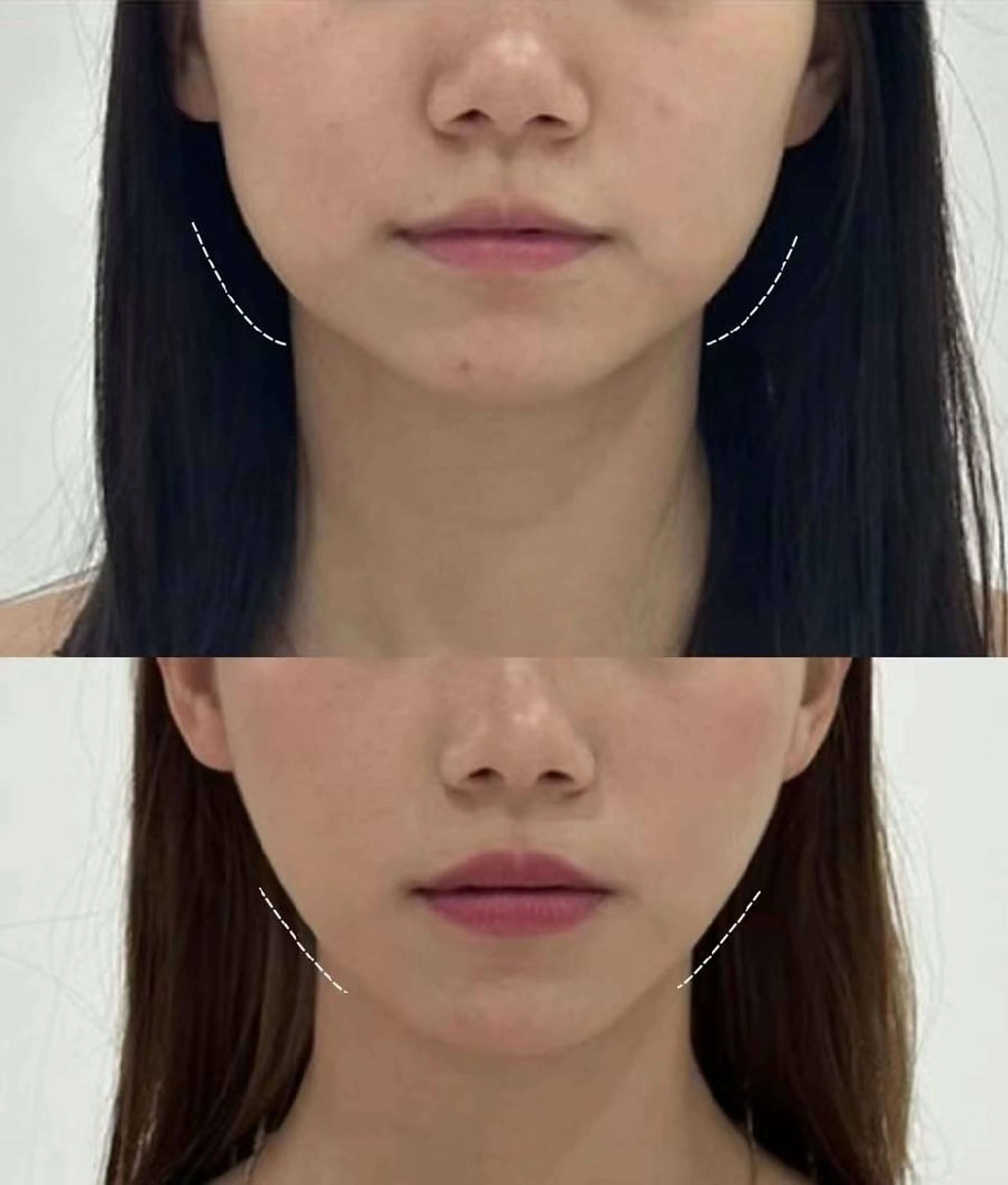 ネイル ブライダルネイル ホワイト aliaハイフ&水光ジェットサロン所属・aliaハーブ水光店 エステティシャン募集のエステ・リラクイメージ