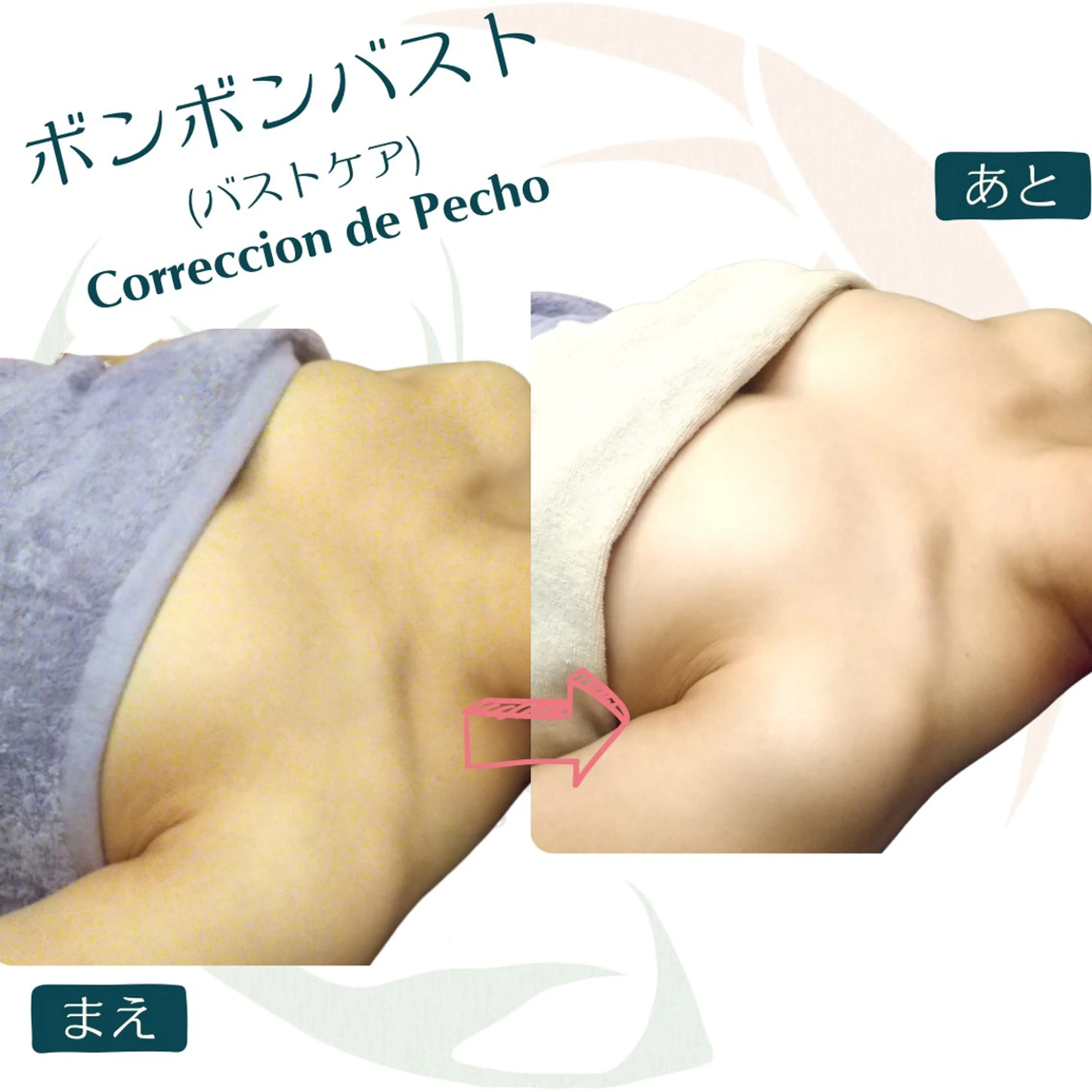 小顔矯正☀︎バスト ☀︎ハルのエステ・リラクイメージ