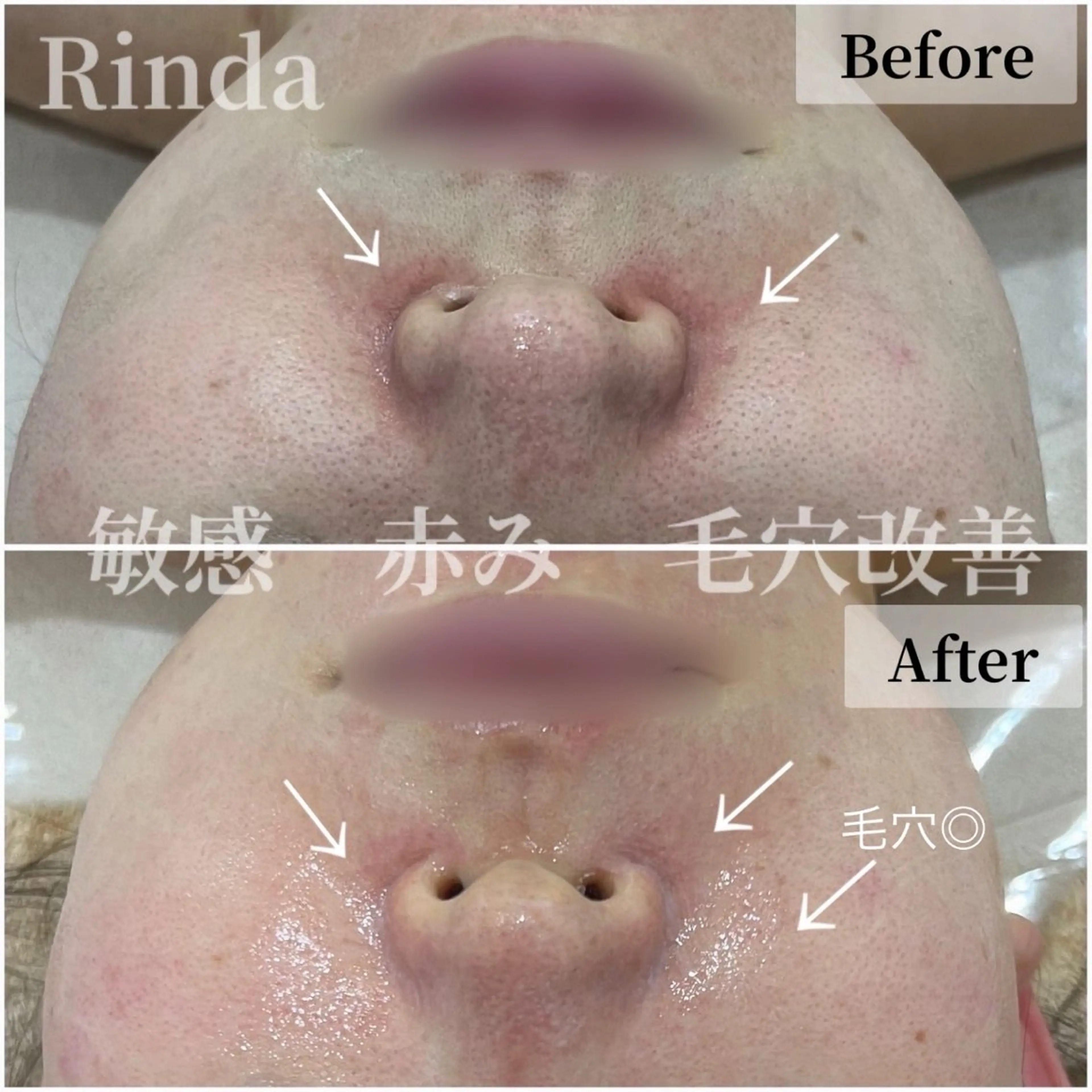 ブライダル痩身×脱毛 尼崎駅前サロンのエステ・リラクイメージ