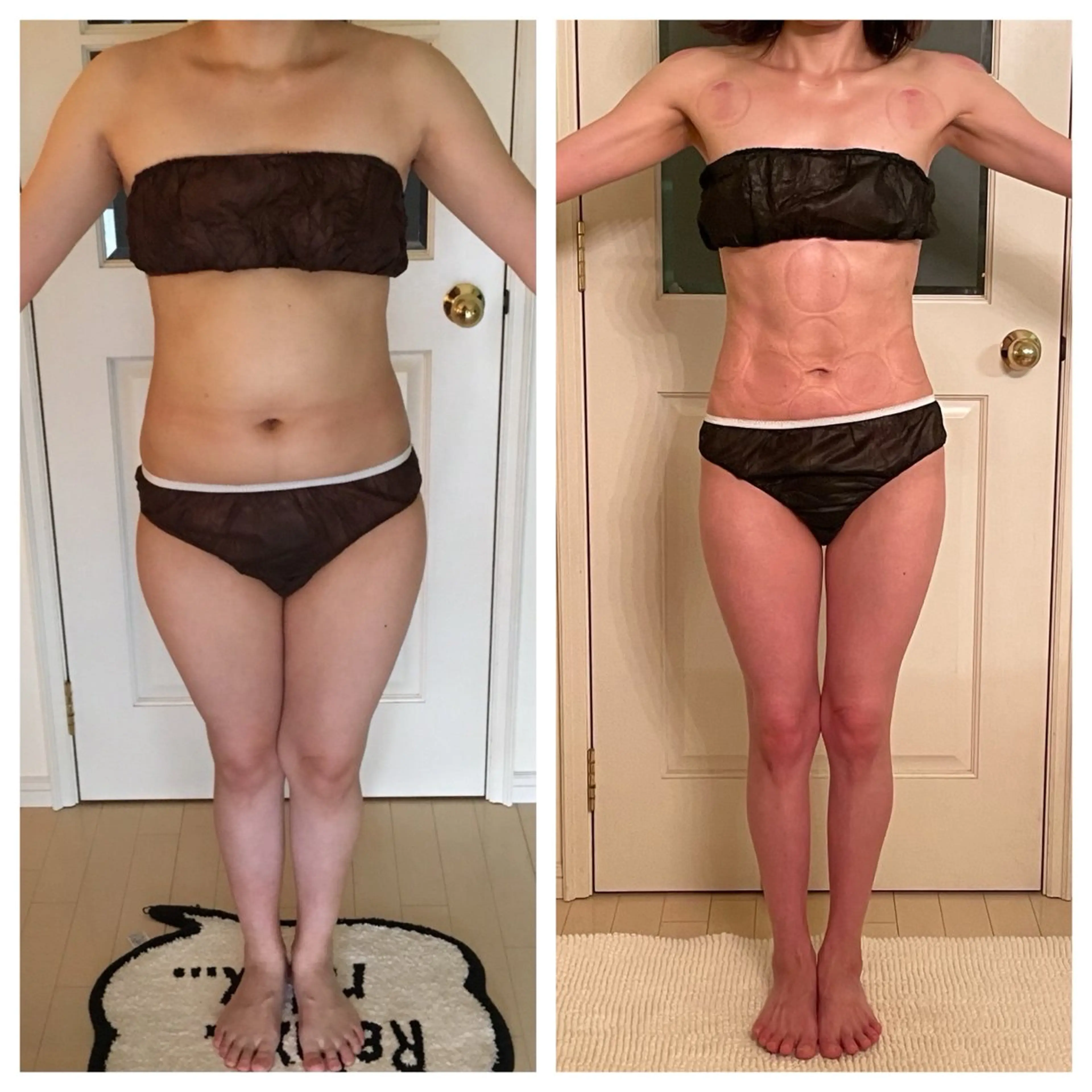 エステ リラク 吸い玉痩身専家所属・吸い玉 痩身専家FDLのエステ・リラクイメージ