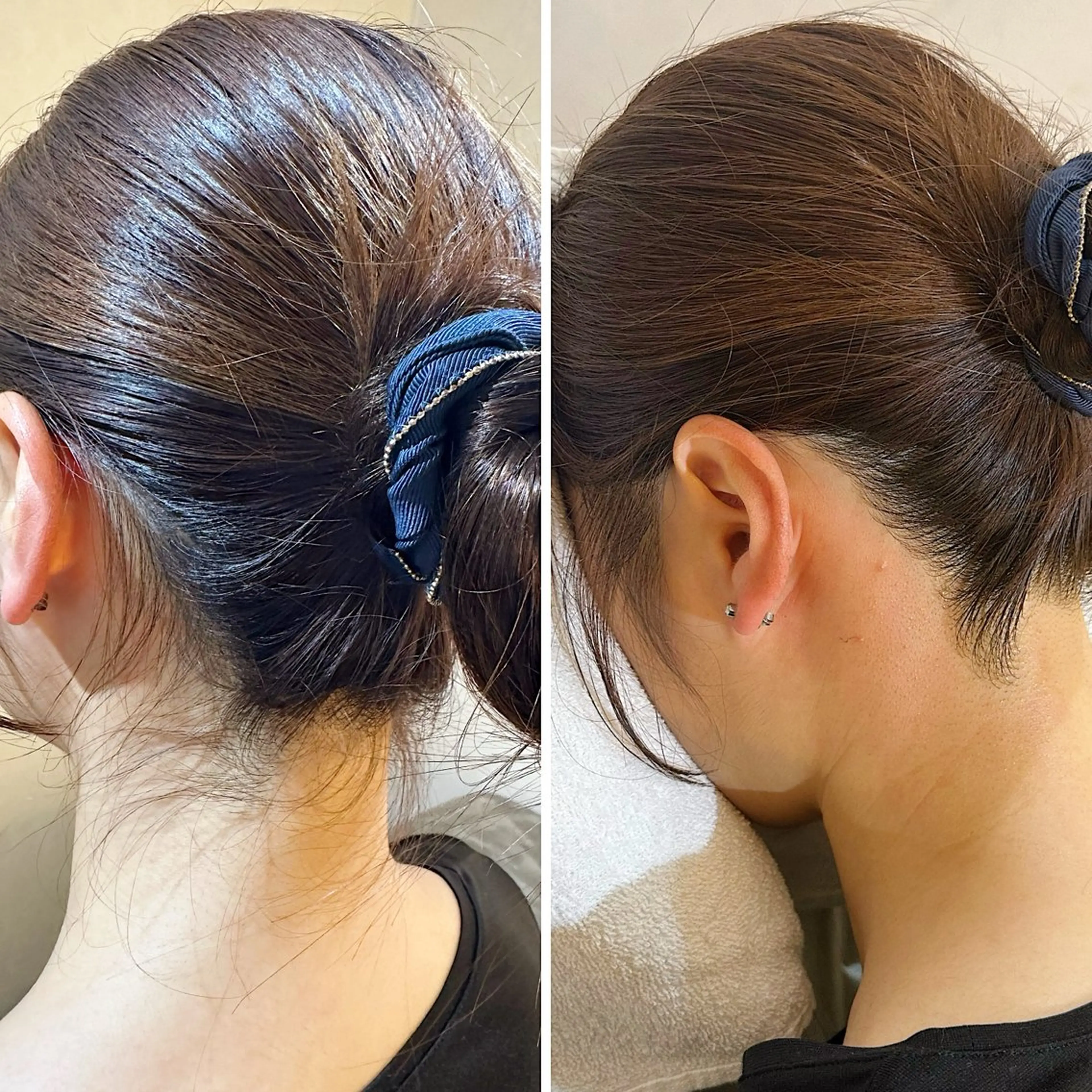 脱毛 うなじ脱毛/美肌脱毛 LABELのエステ・リラクイメージ