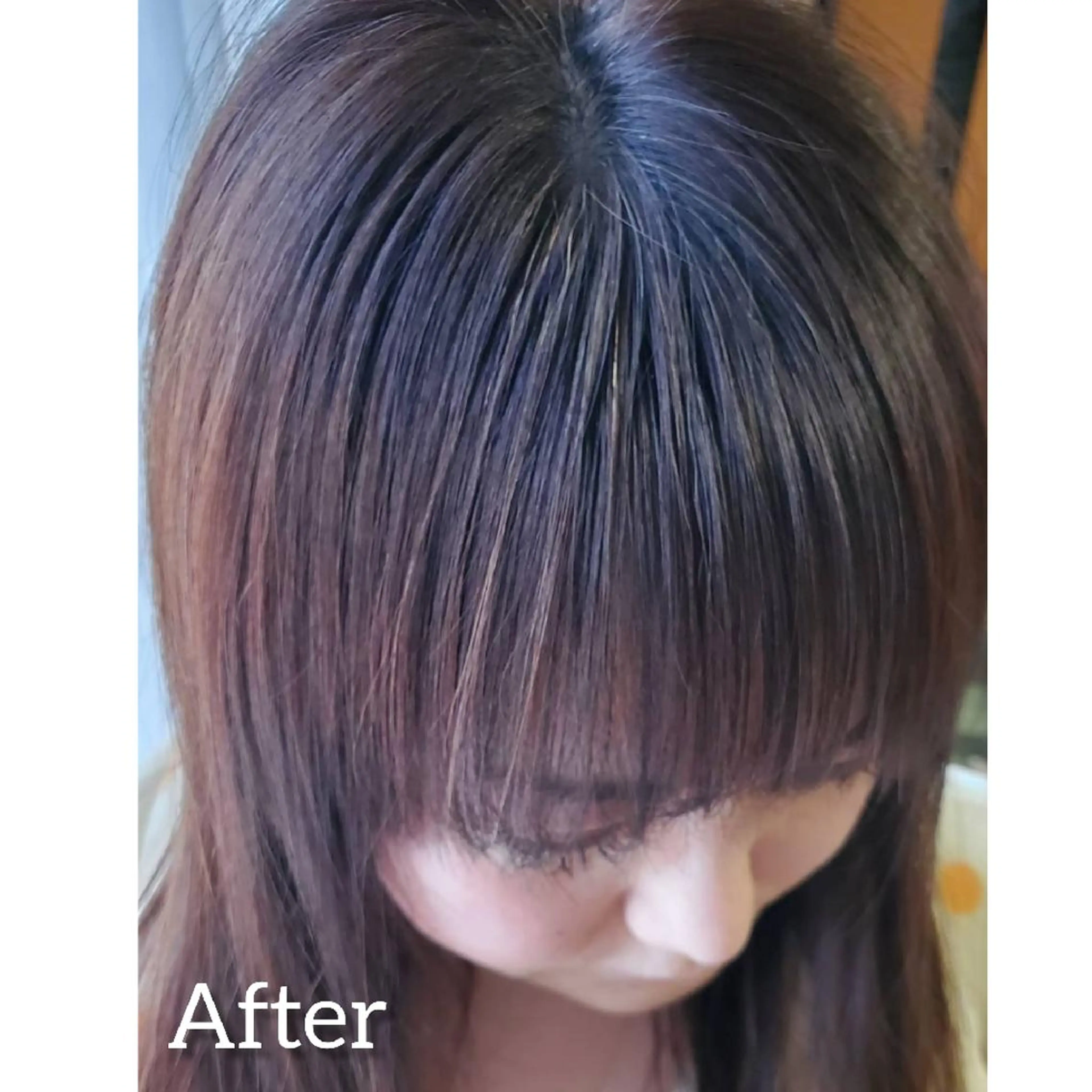 歯科提携セルフダック 宇都宮駒生店のエステ・リラクイメージ