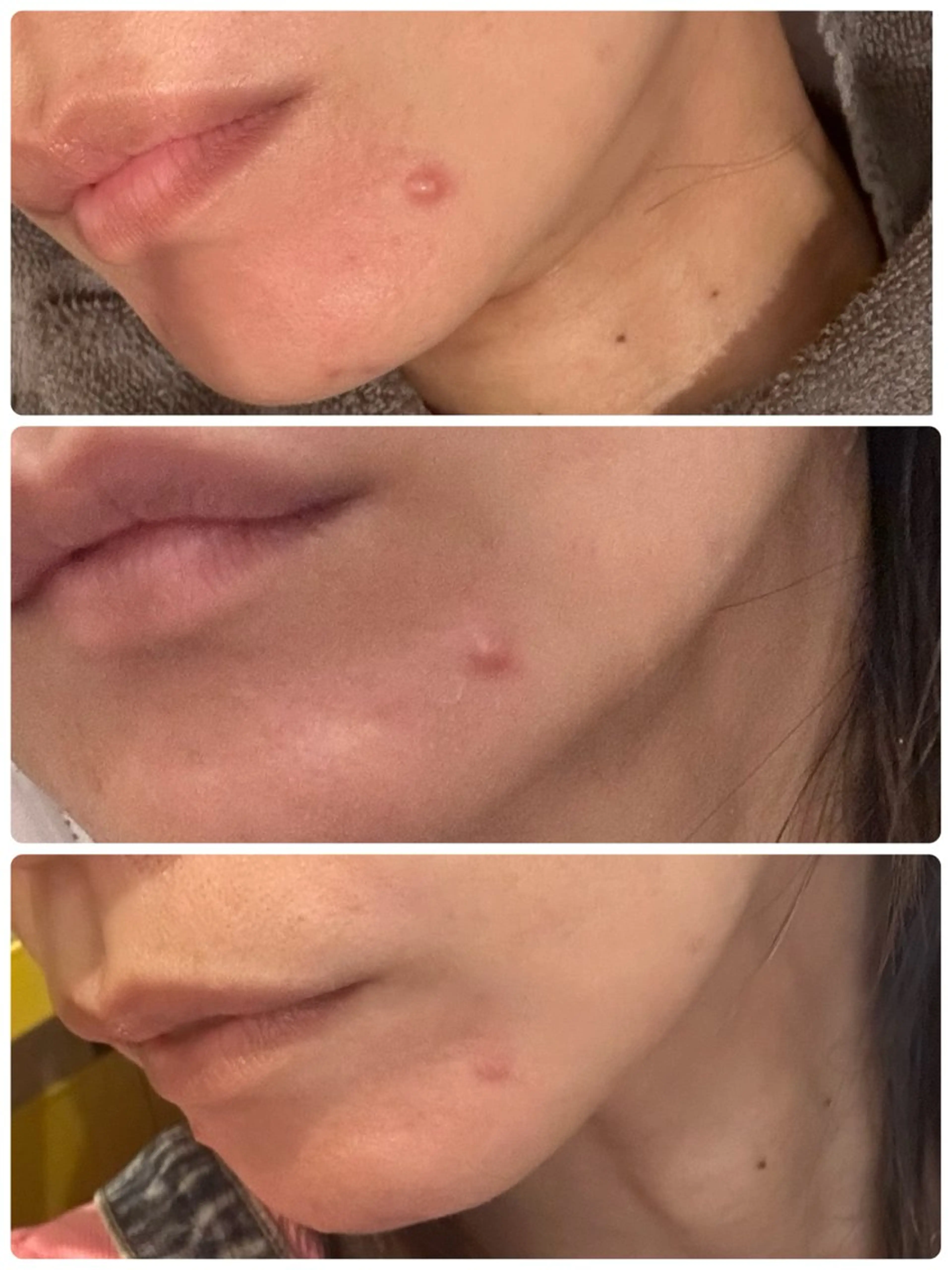 脱毛 yellow.所属・yellow💛【 脱毛&フェイシャル】のエステ・リラクイメージ