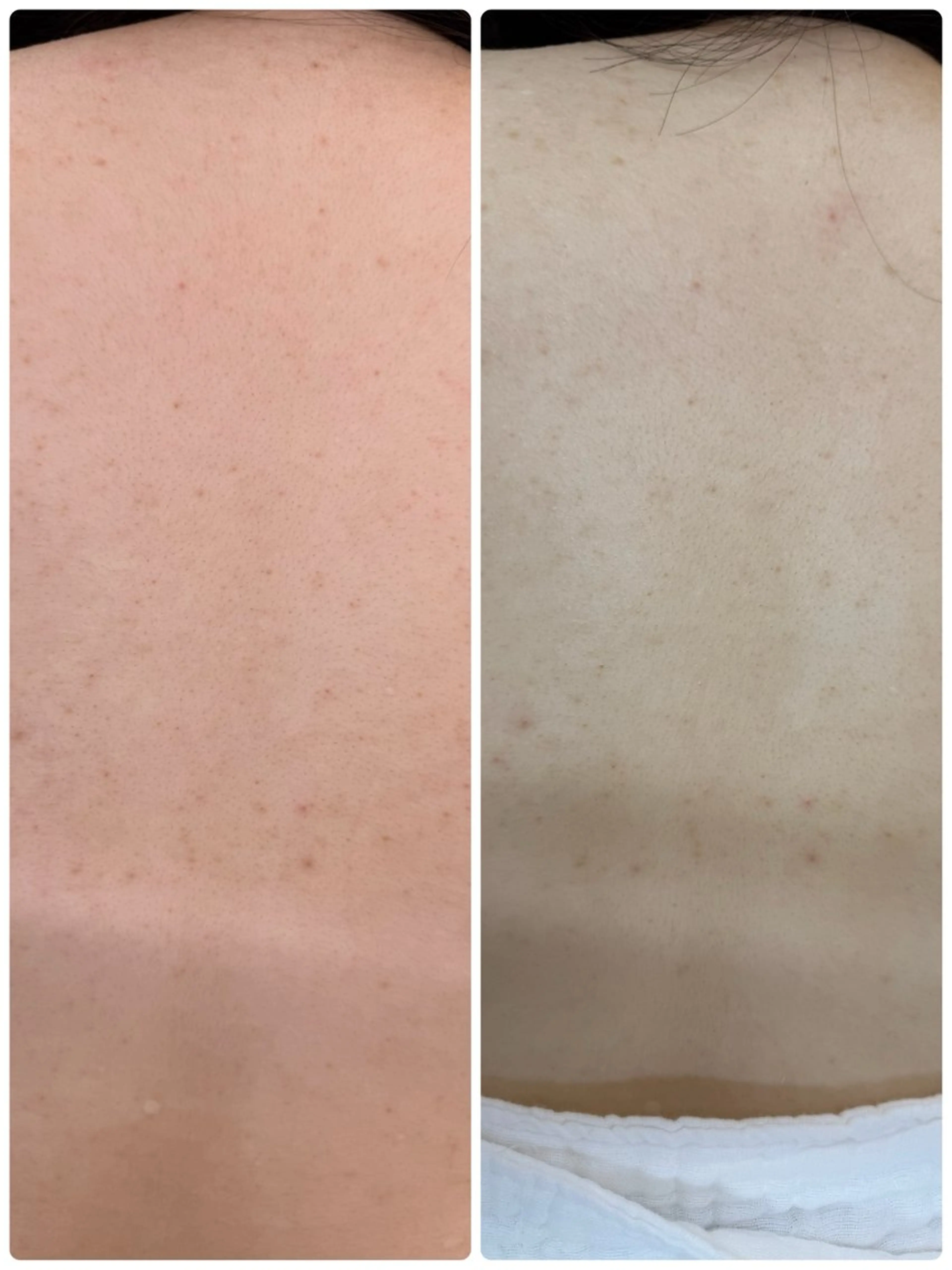 salon merci和泉のエステ・リラクイメージ