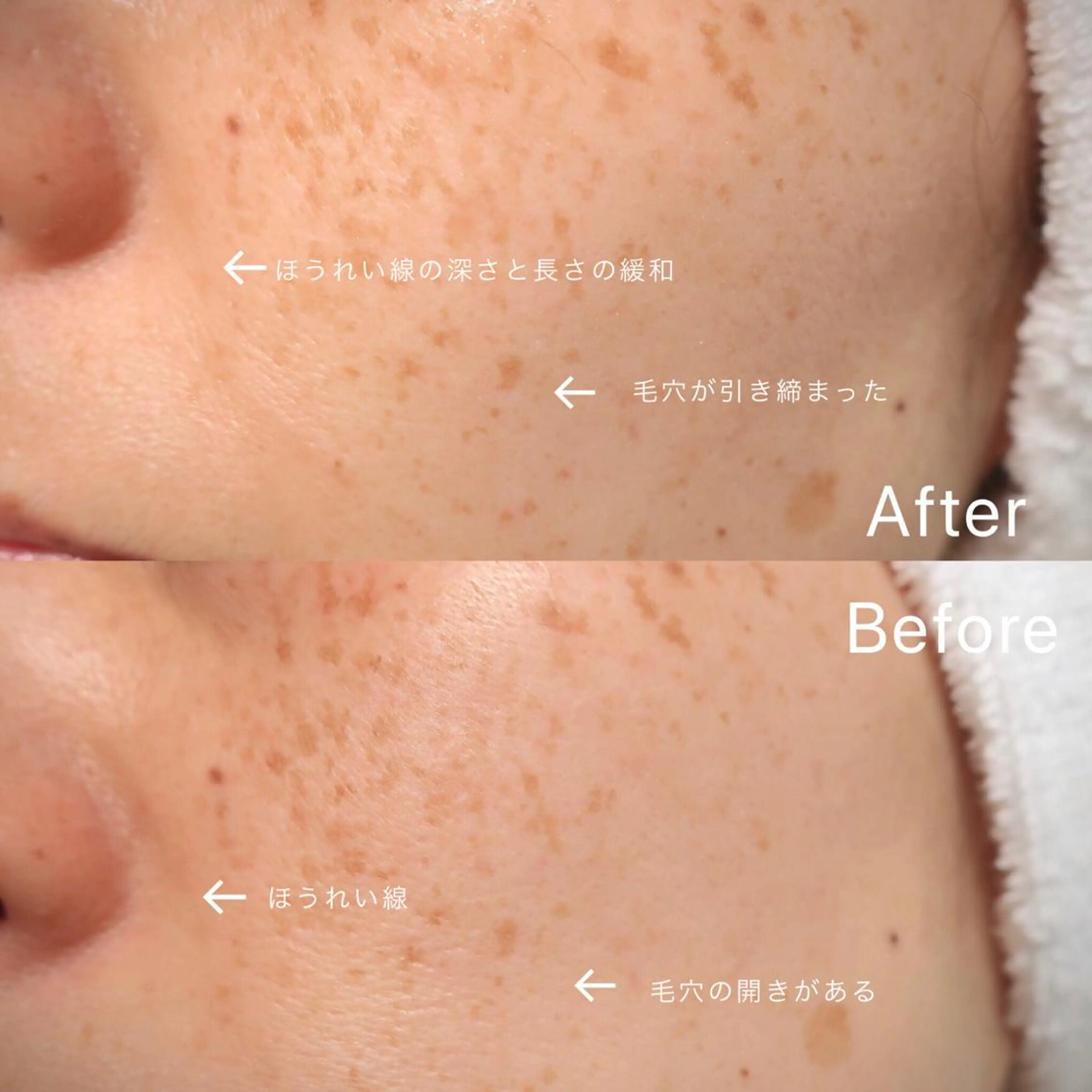 つきかわ ともみのネイルデザイン