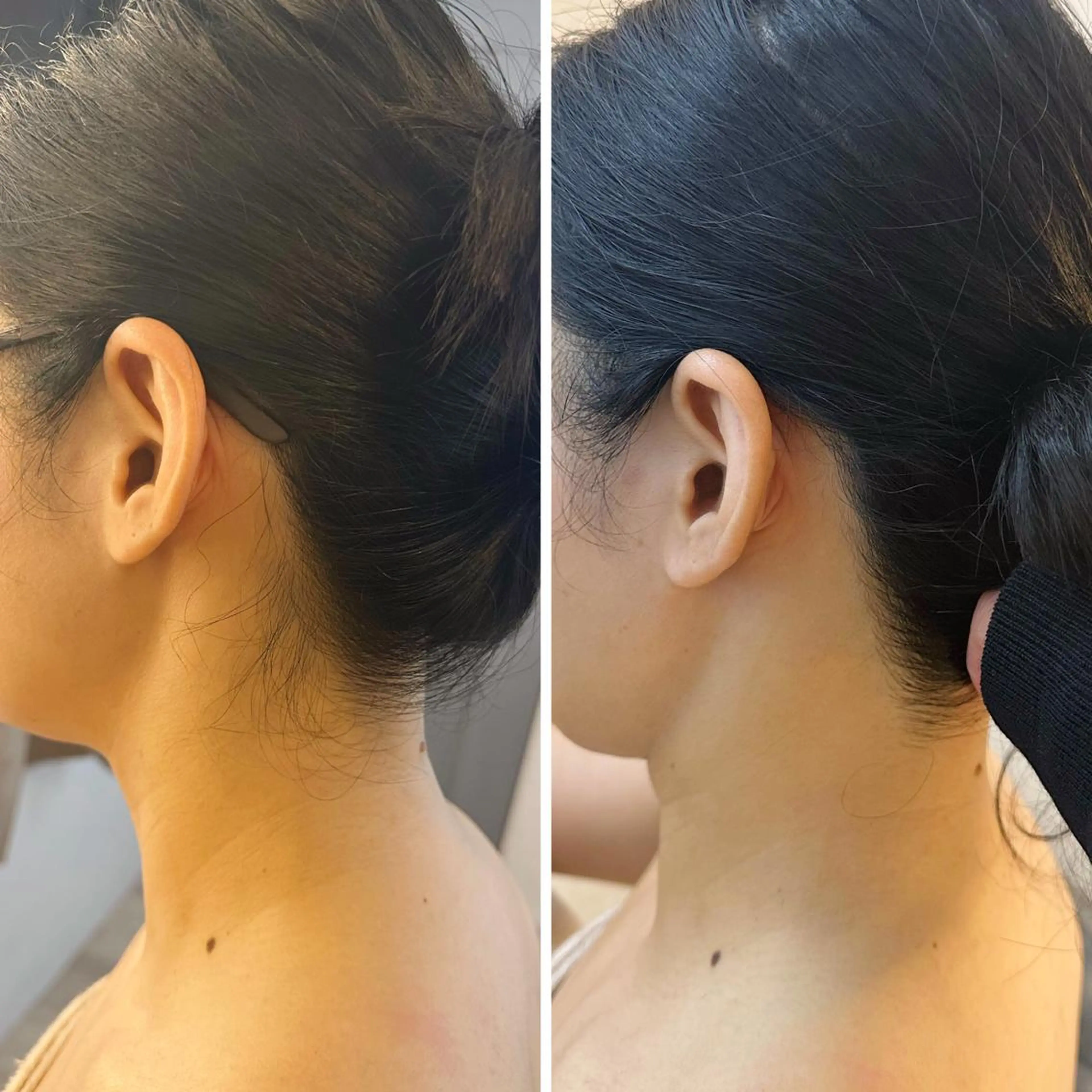 脱毛 うなじ脱毛/美肌脱毛 LABELのエステ・リラクイメージ