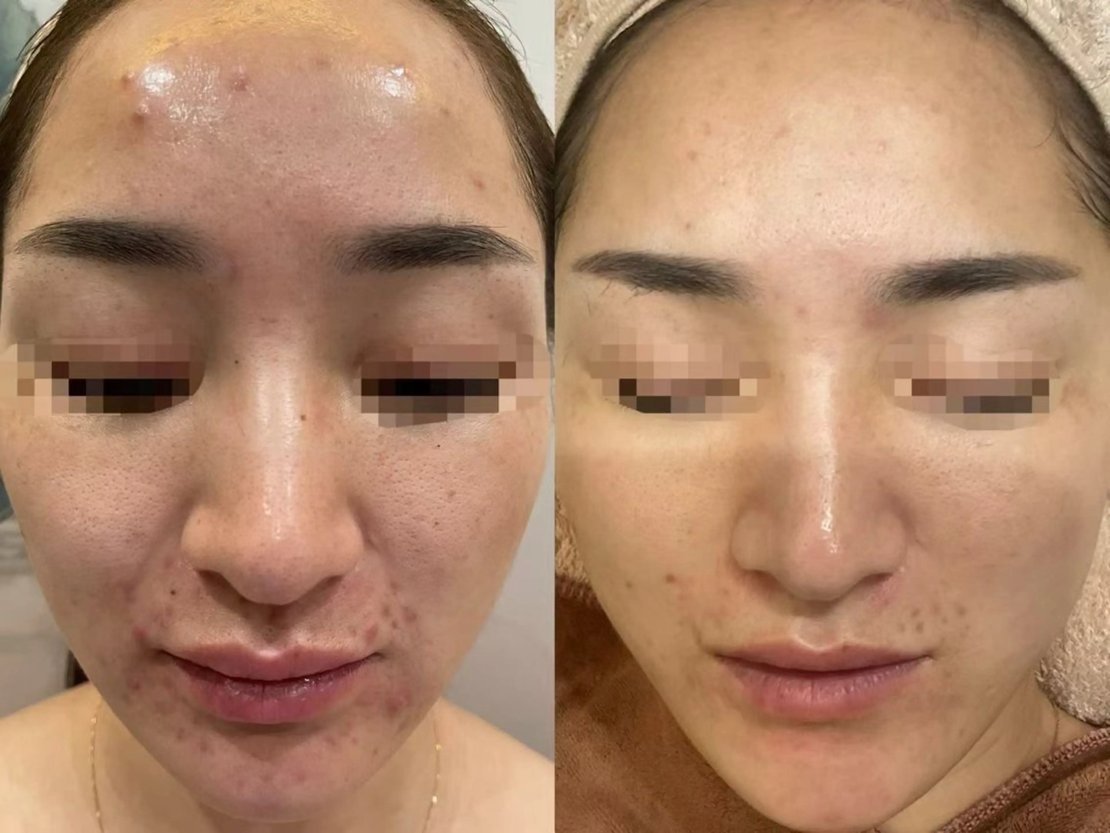 マツエク・マツパ エステ リラク 愛維美水光美肌専門店所属・愛維美水光美肌専門店 メンズレディースokのエステ・リラクイメージ