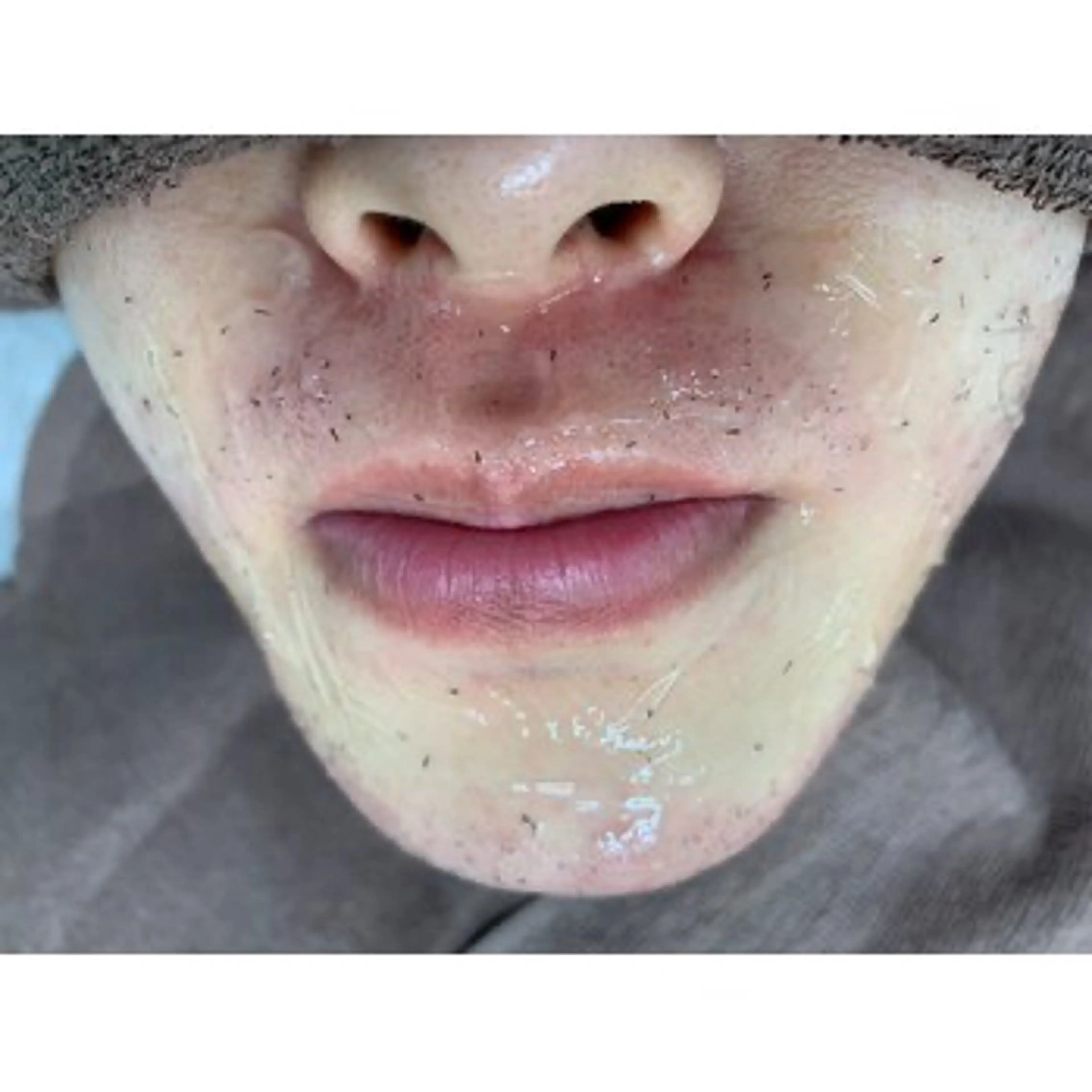 メンズ 脱毛 脱毛サロン BRIDGE橋本のエステ・リラクイメージ