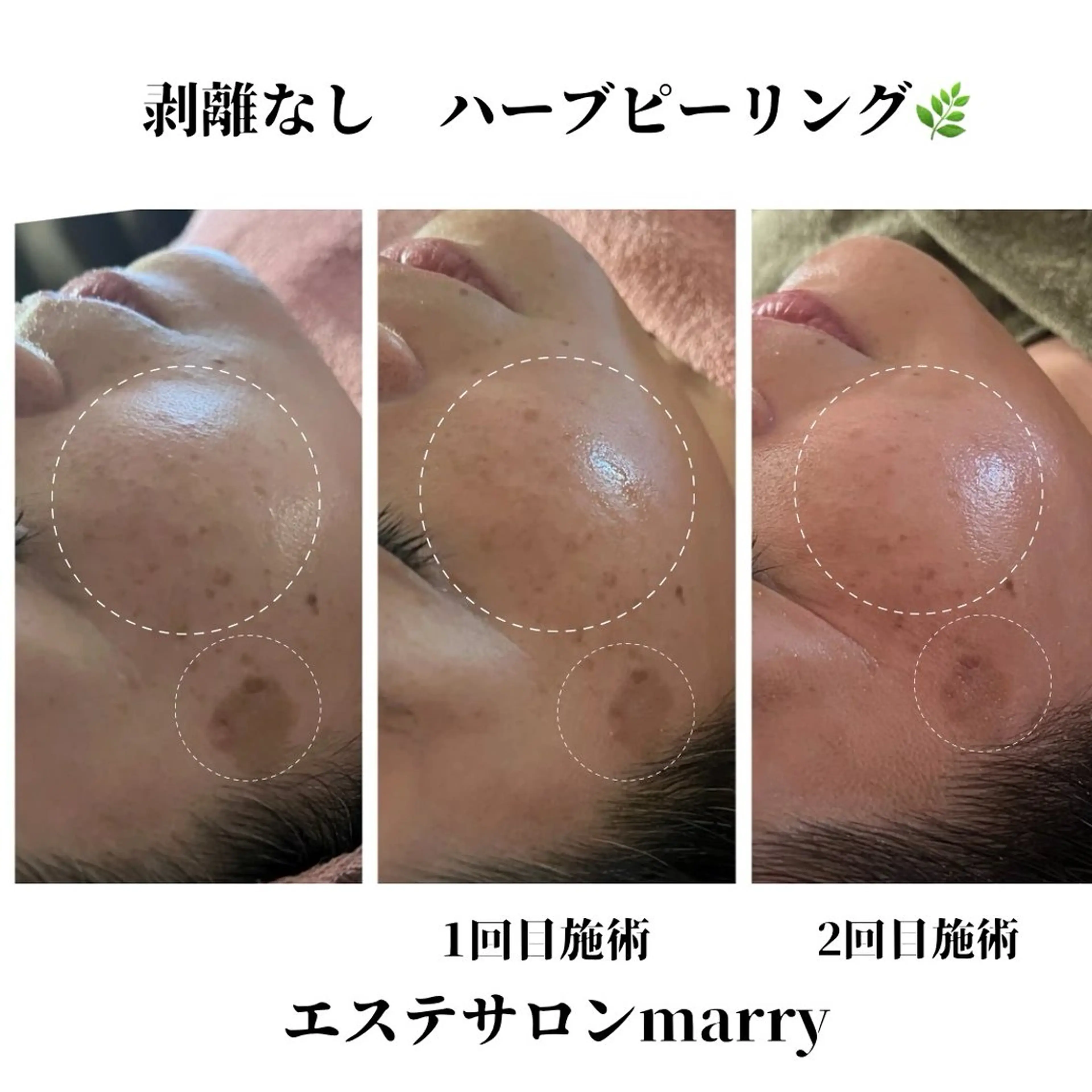 エステサロンmarry所属・エステサロン marryの眉毛・アイブロウイメージ