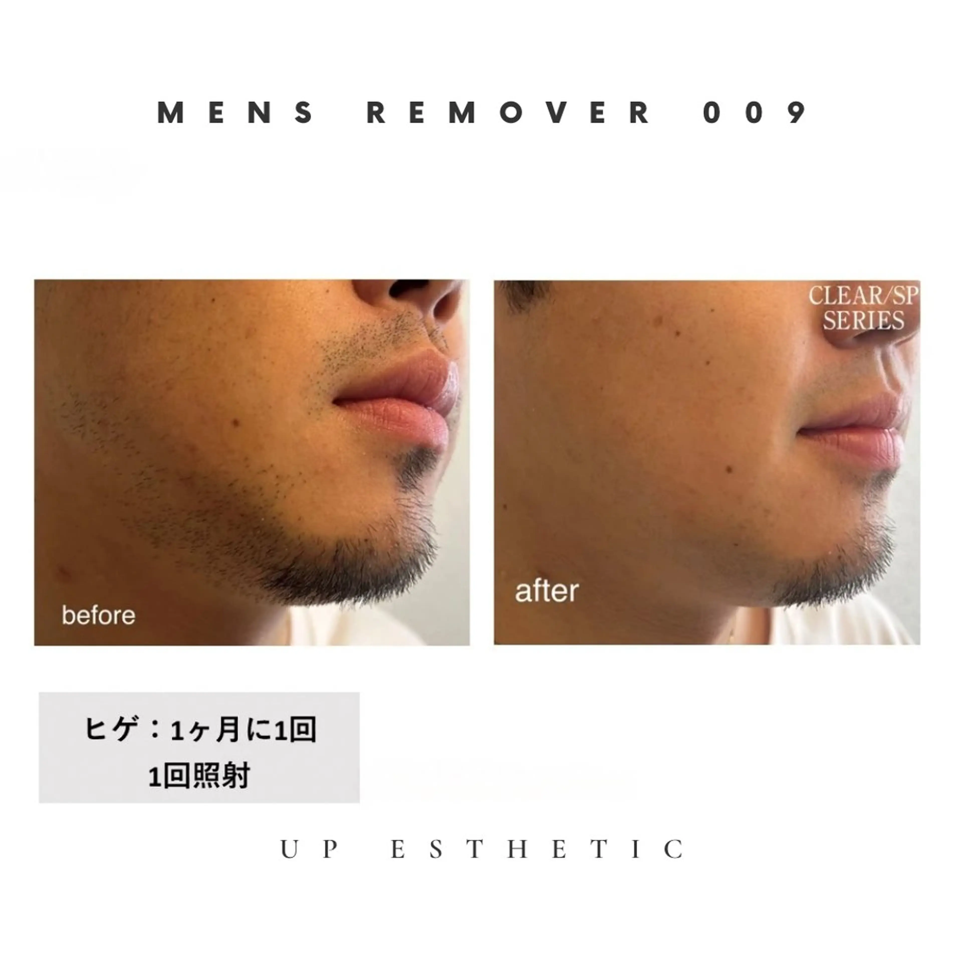 メンズ 脱毛 ウプエステティック所属・韓国肌管理 ウプエステティックのエステ・リラクイメージ