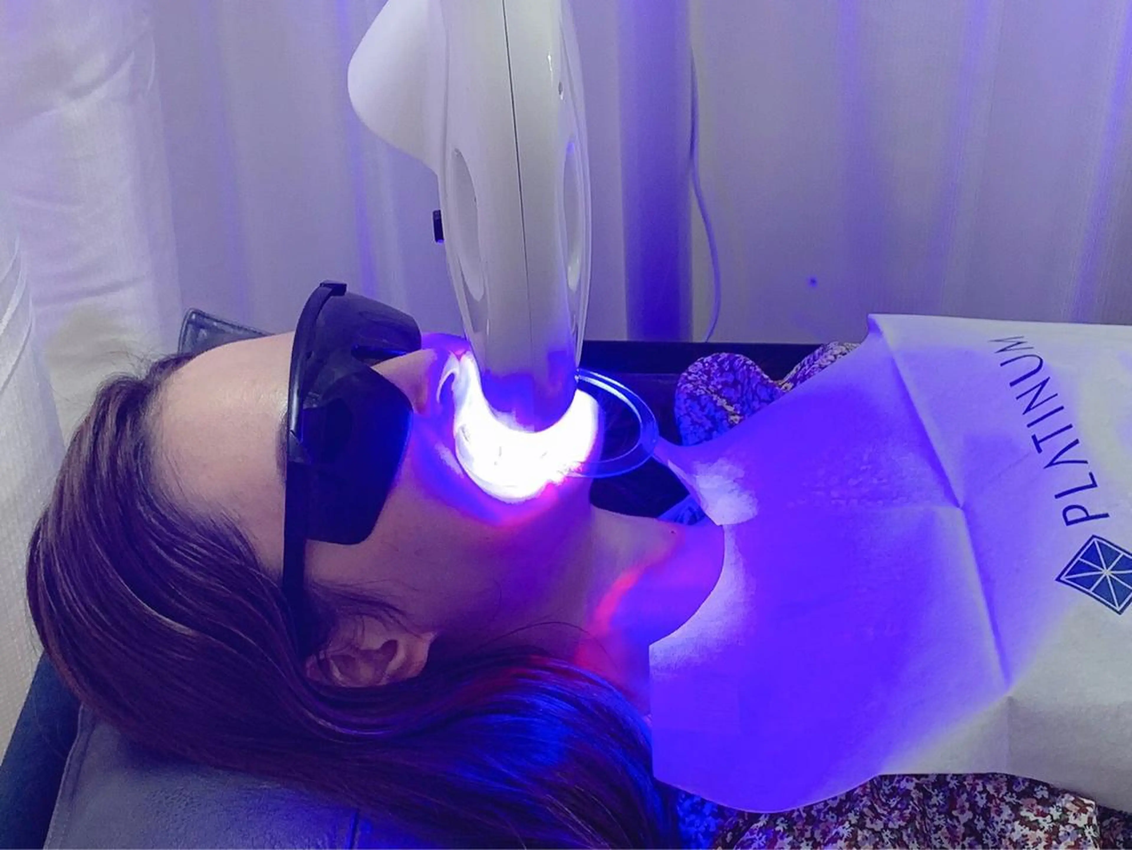 その他 White Berry SELF BEAUTY SALON所属・セルフホワイトニング 🦷口元垢抜け✨のその他イメージ