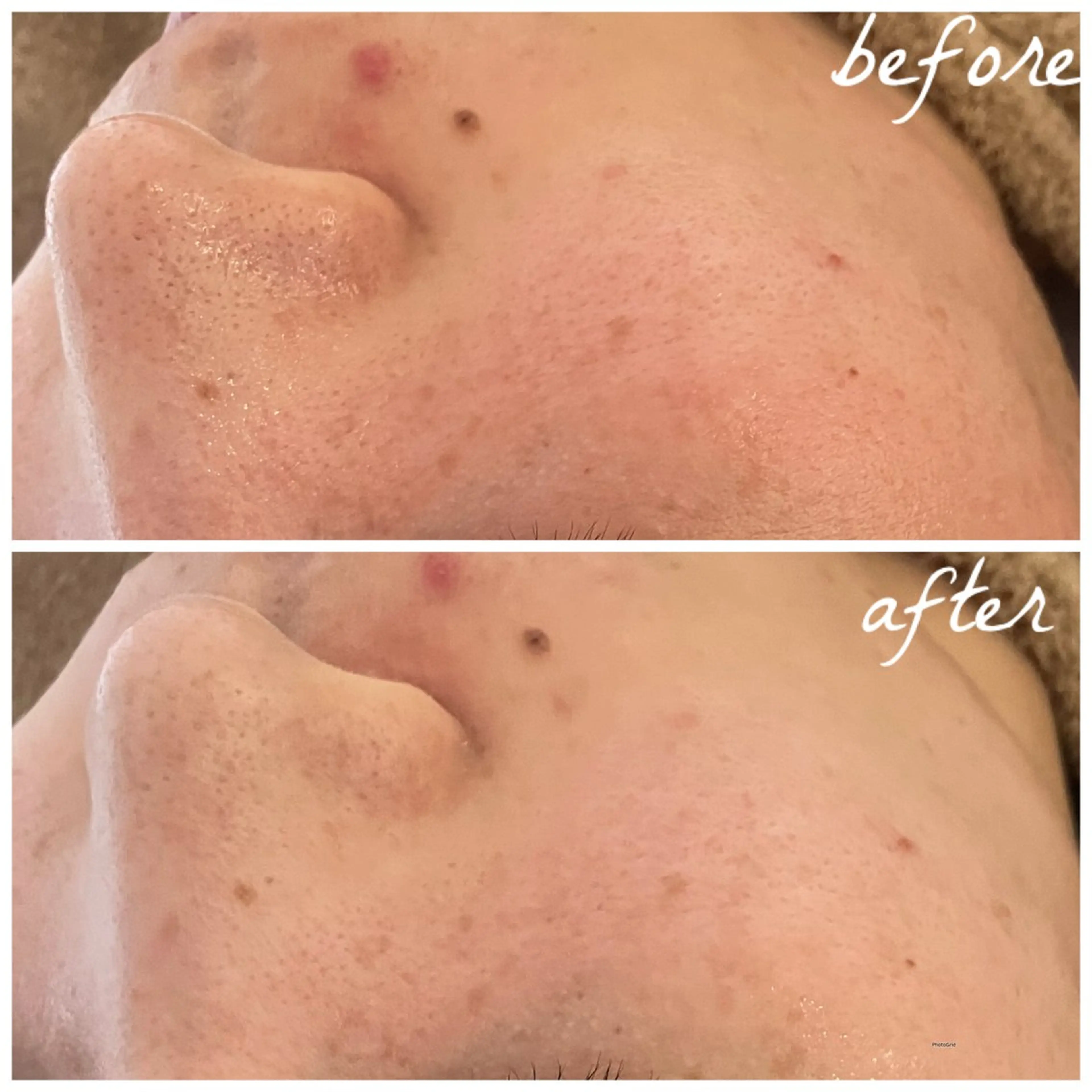 メンズ エステ メナード岐阜茜部 杉浦のエステ・リラクイメージ