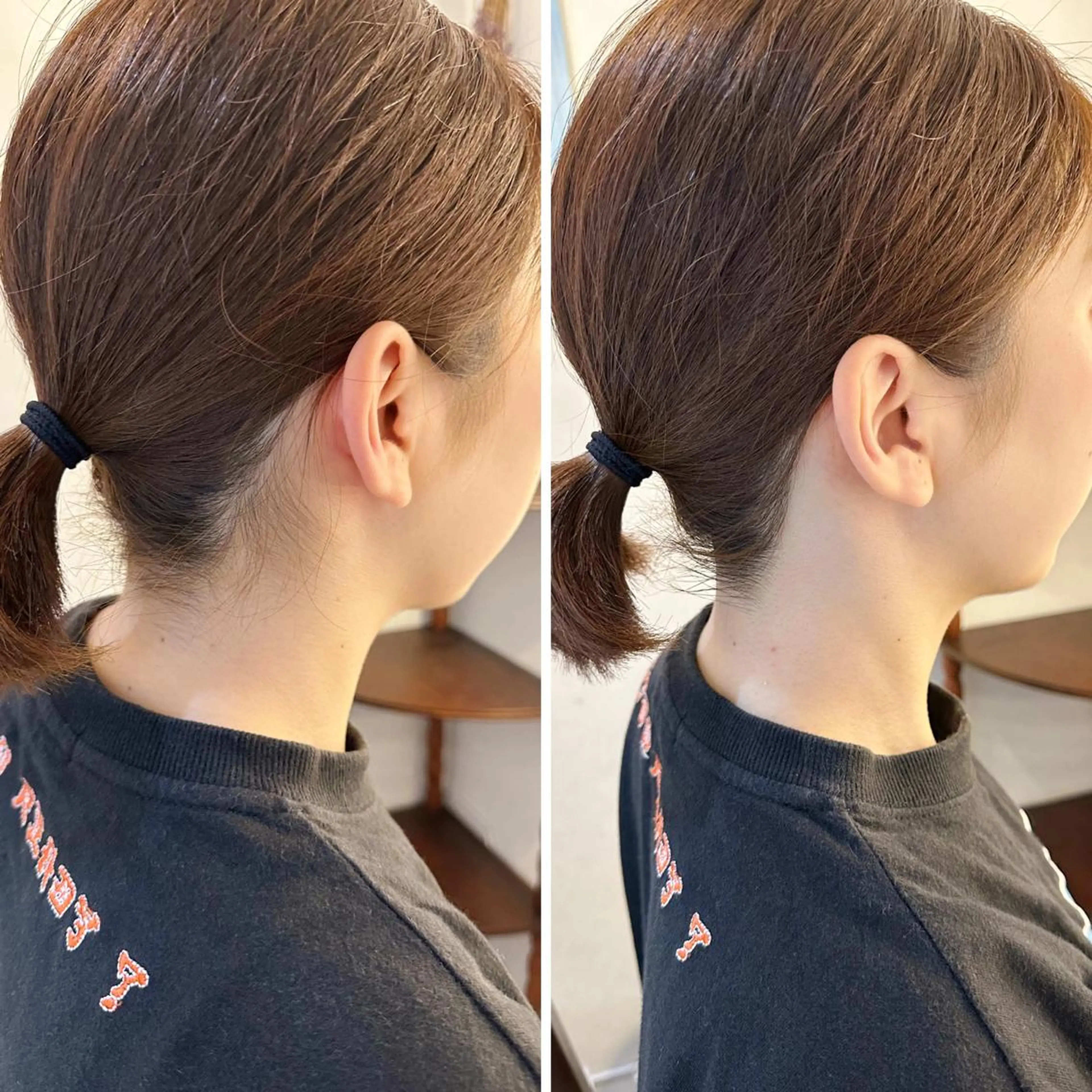 脱毛 うなじ脱毛/美肌脱毛 LABELのエステ・リラクイメージ