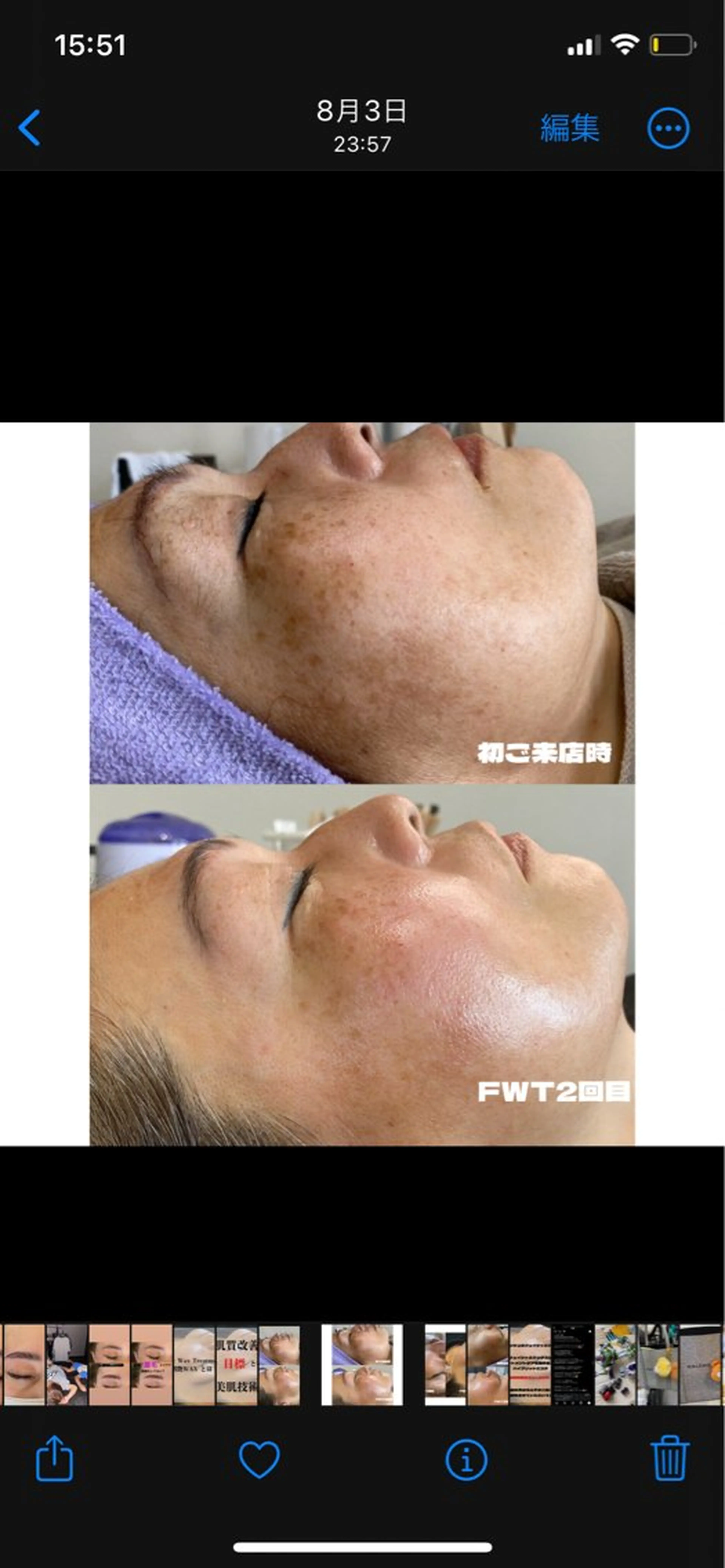 初回お試し価格‼️潤艶Wax🫧毛穴引き締めパック付！【産毛・角質ごっそり除去】の写真