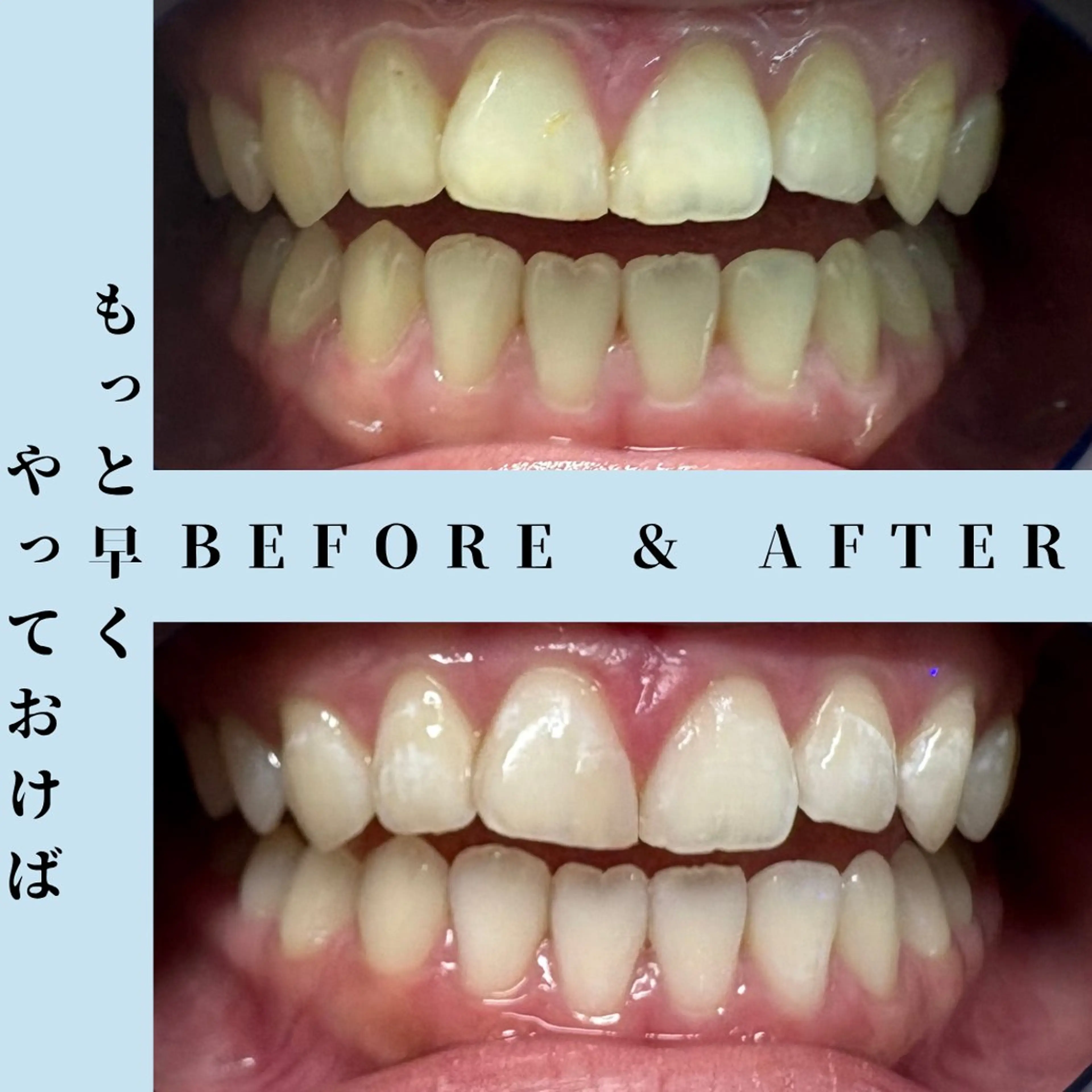 その他 セルフホワイトニング Dolce水戸店のその他イメージ