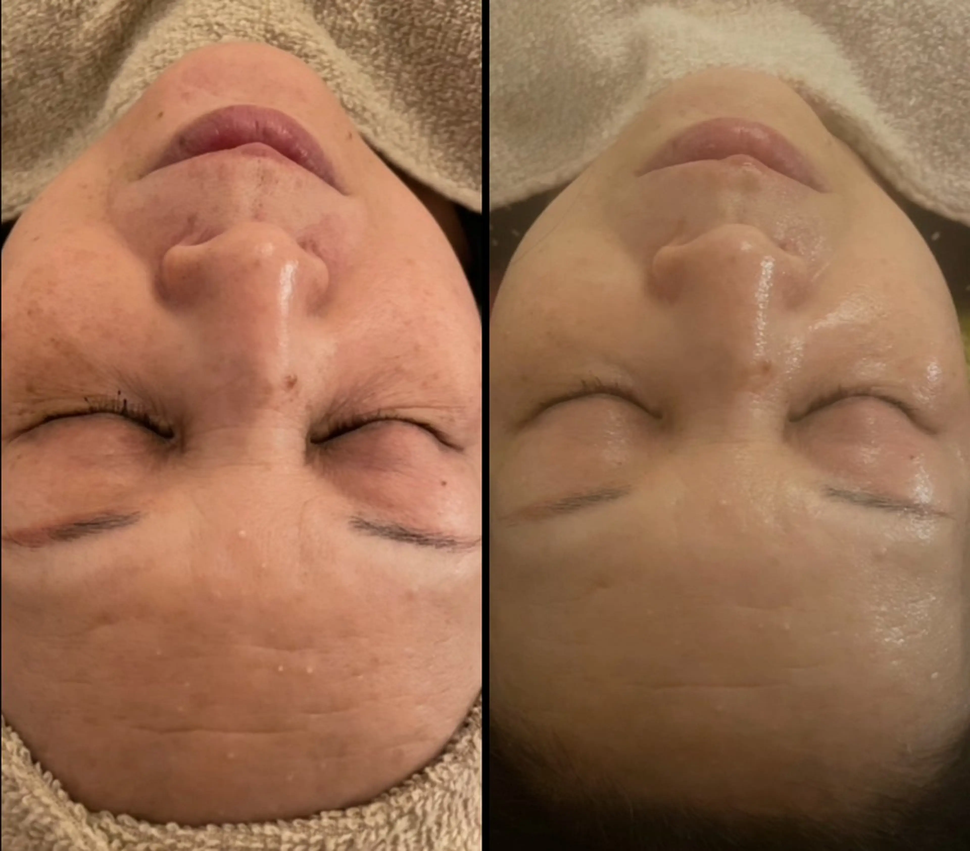 beauty lanaのエステ・リラクイメージ