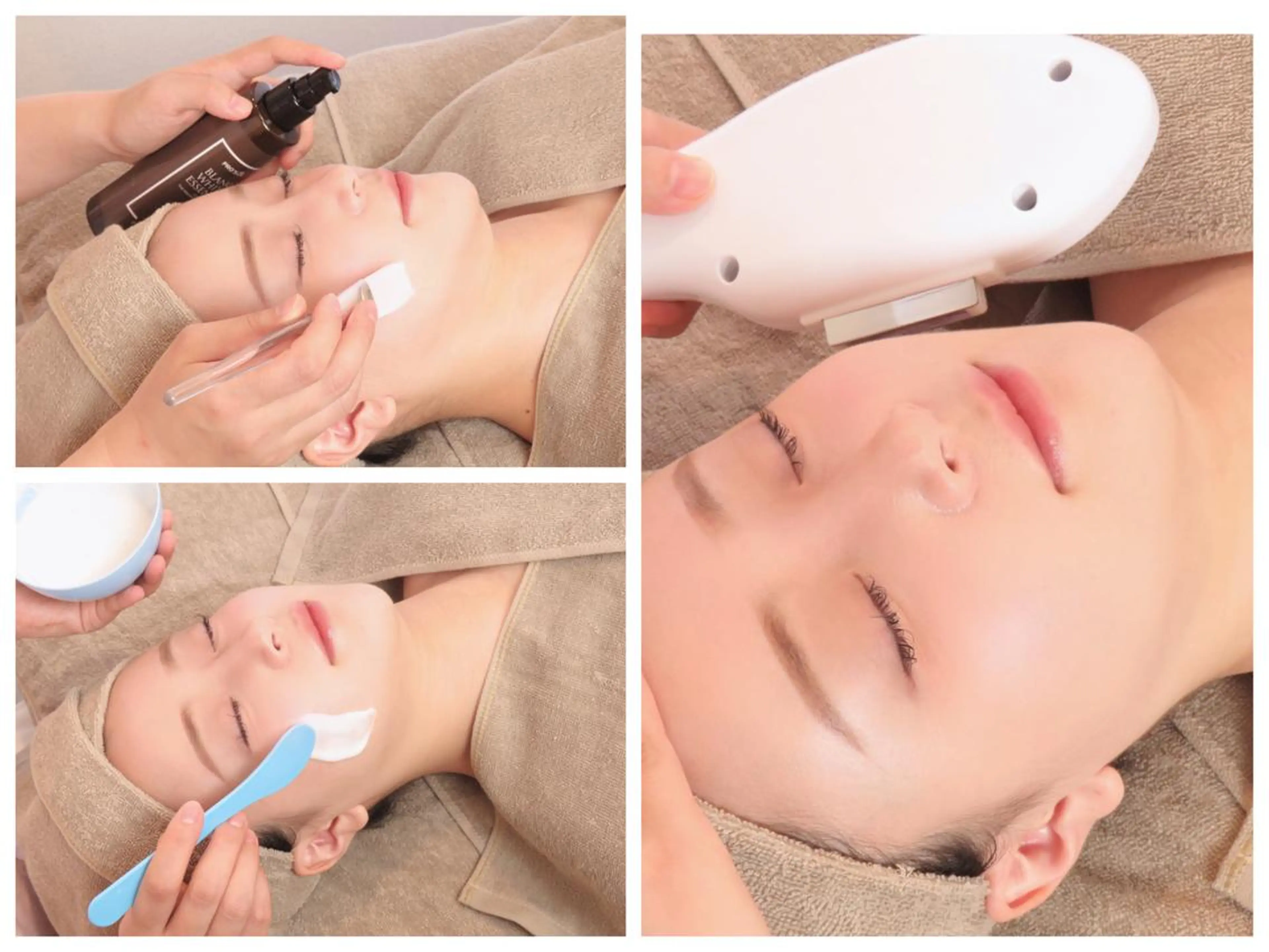 【ニキビケア/ニキビ跡ケア】毛穴洗浄＆光フェイシャル✨ニキビ跡とさよなら❗️クリアな美肌に！の写真