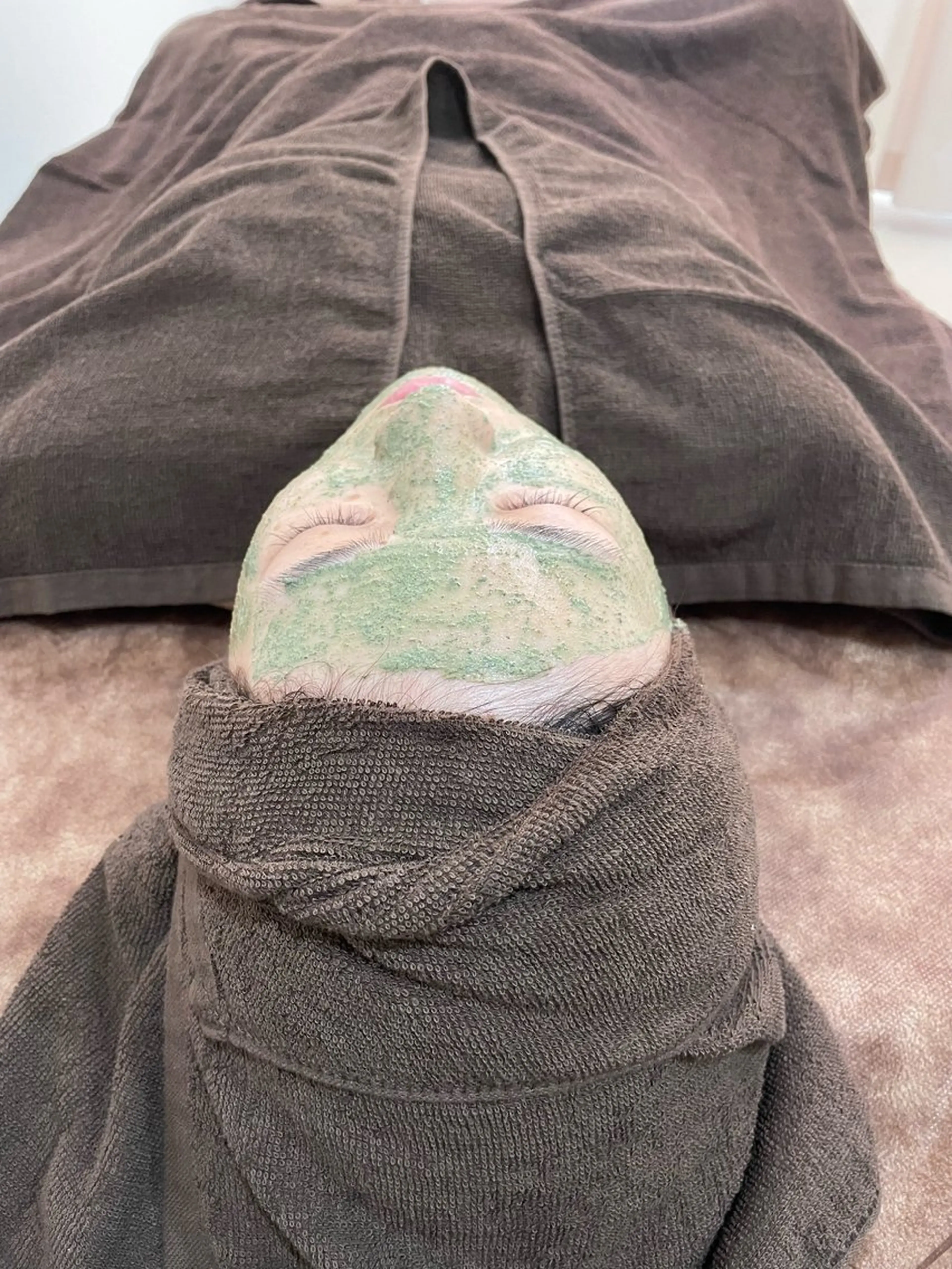 思春期ニキビ・肌荒れ改善！デトックス効果で老廃物を外に出して美肌美人！【VCF】の写真