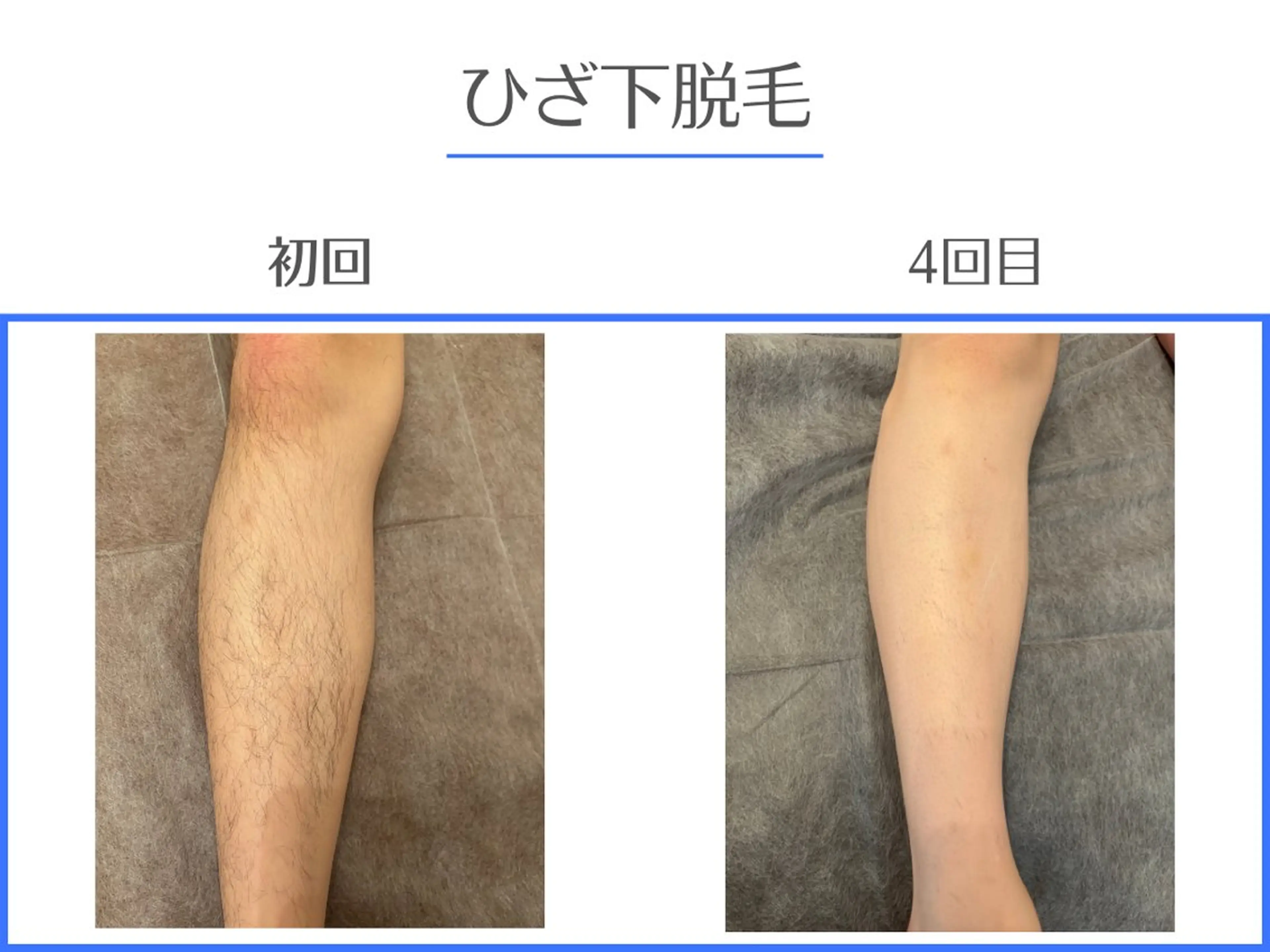 ホワイトニング/脱毛 専門店エクシア岡崎店のその他イメージ