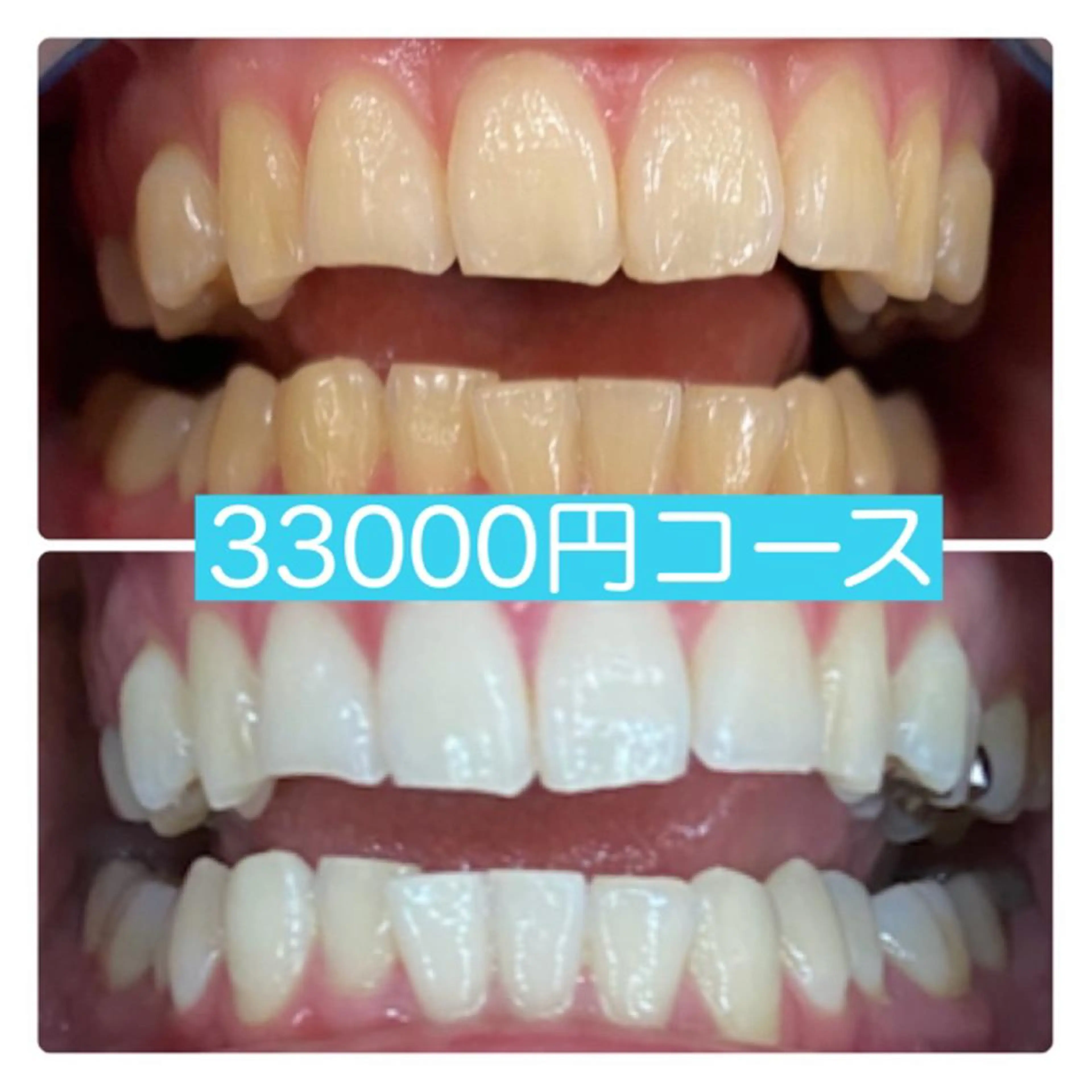 その他 PLATINUM Beauty 横浜店所属・ホワイトニングルーム 横浜店のその他イメージ