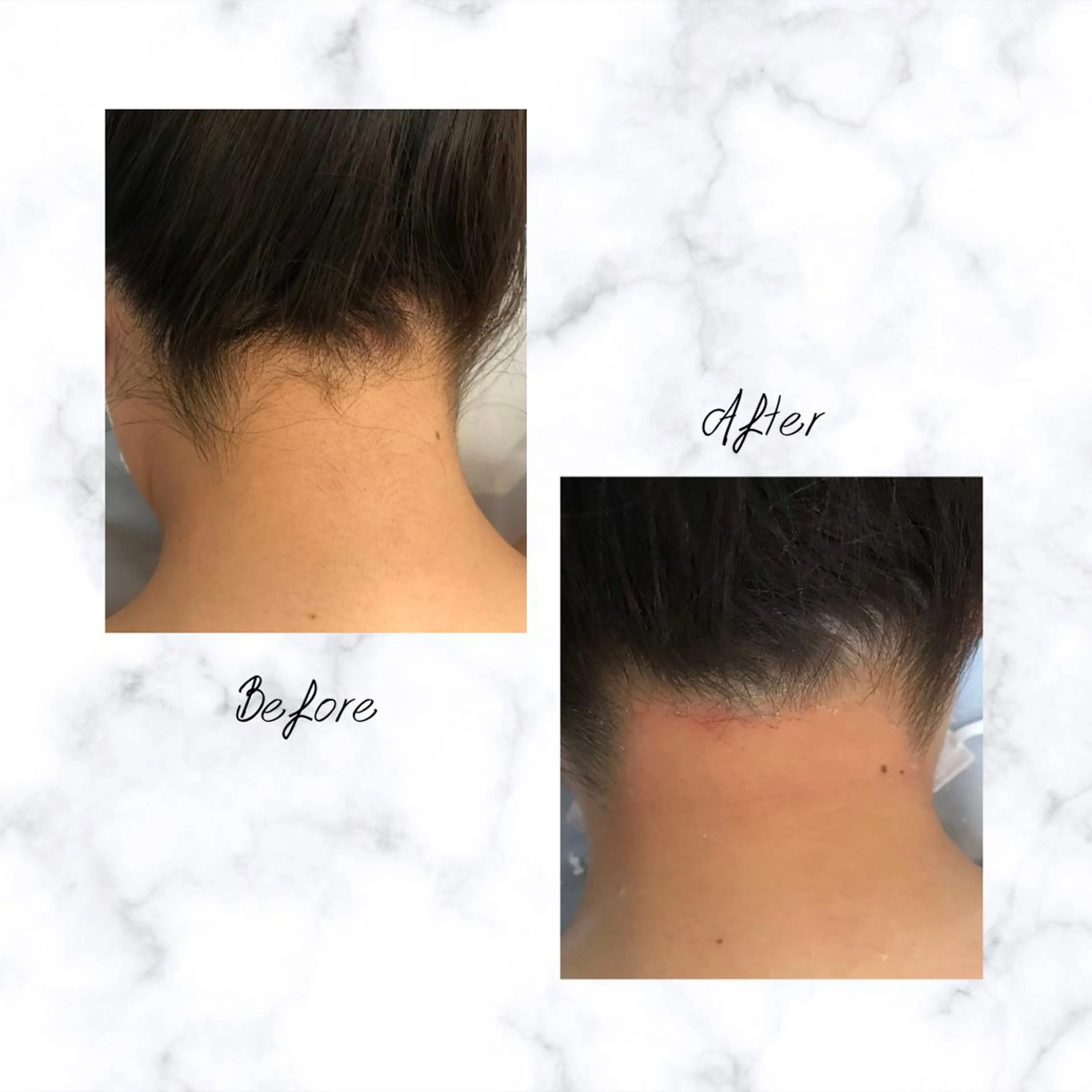 Cielo 上野店のエステ・リラクイメージ