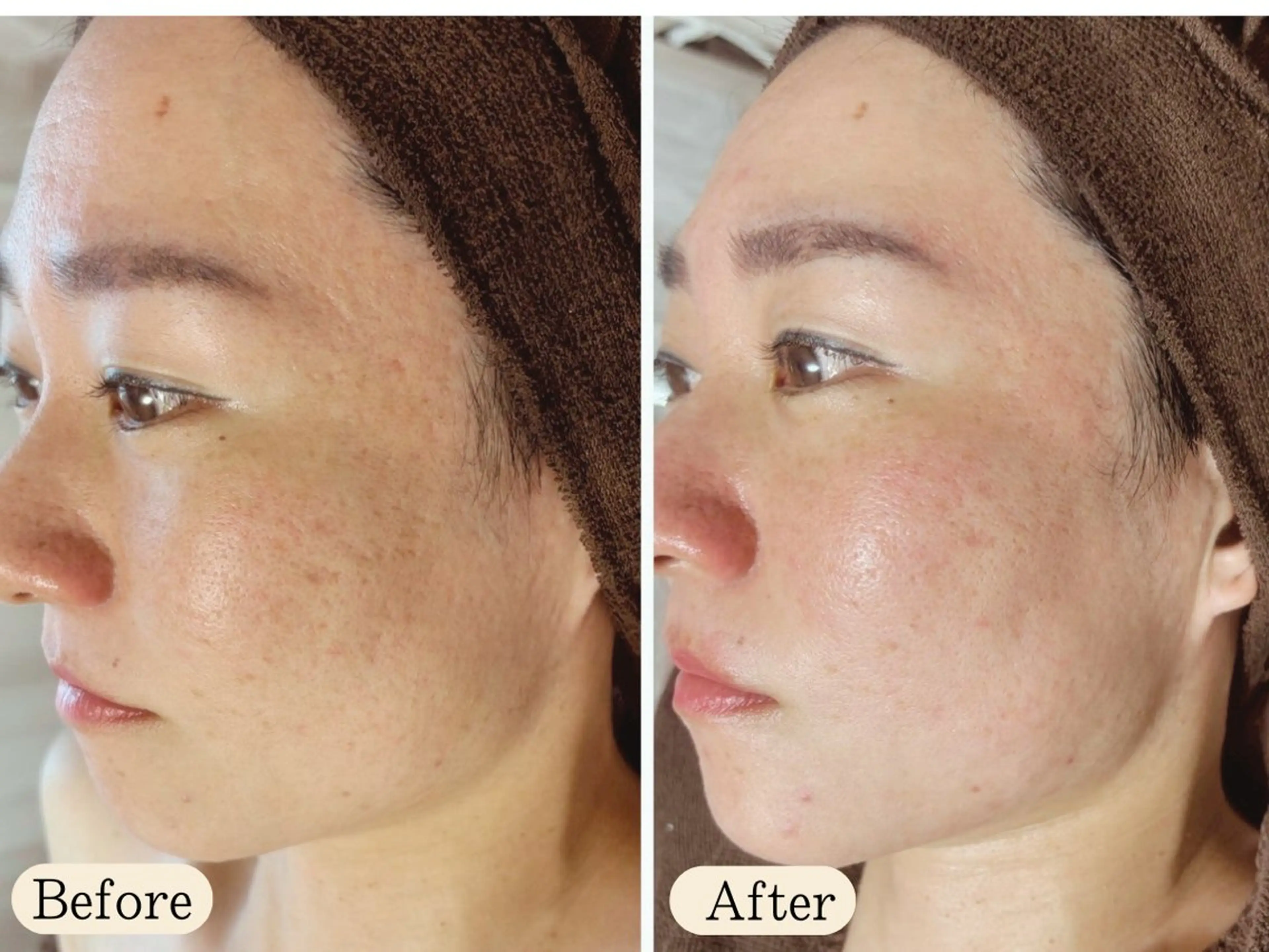 UILANI所属・UI LANIのエステ・リラクイメージ