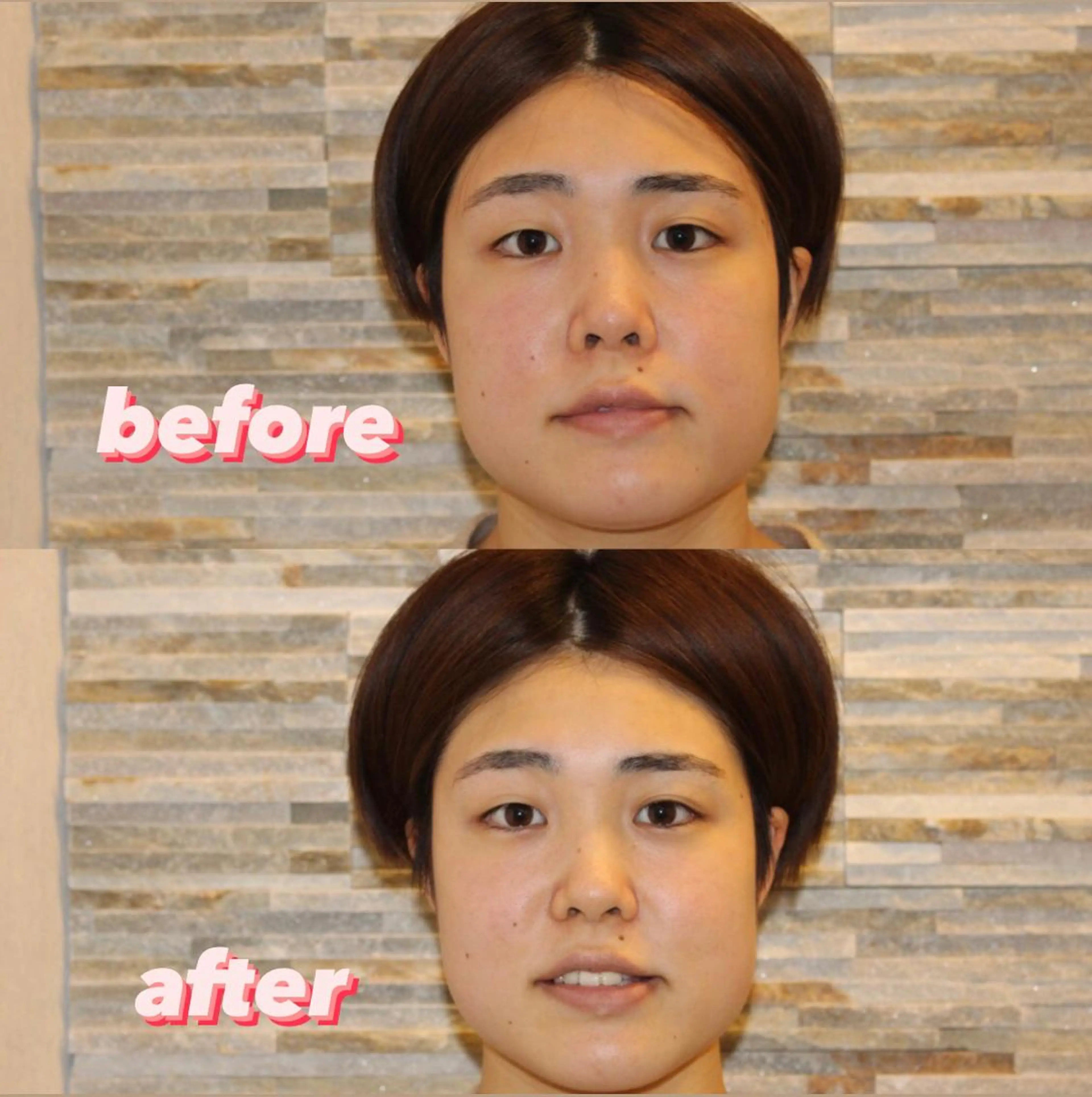 リラク 美容鍼灸整体サロンBeauJu所属・小顔矯/美容鍼/鍼灸 BeauJuのその他イメージ